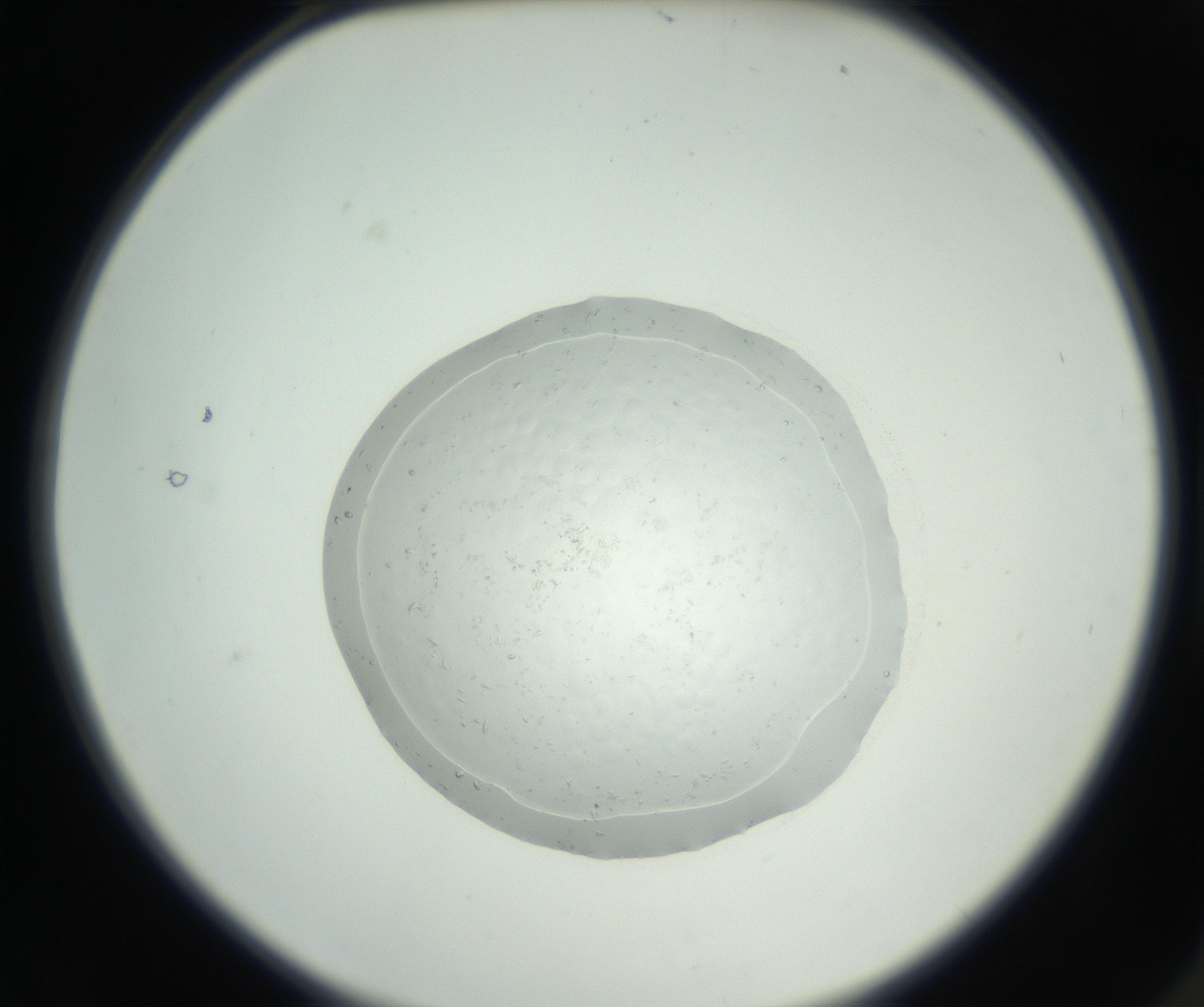 RI01_03_000_0212_Proj1_Clon1_MC_0000MC102667_004_160828_02_01_02_00_99_002_001_RAI.jpg