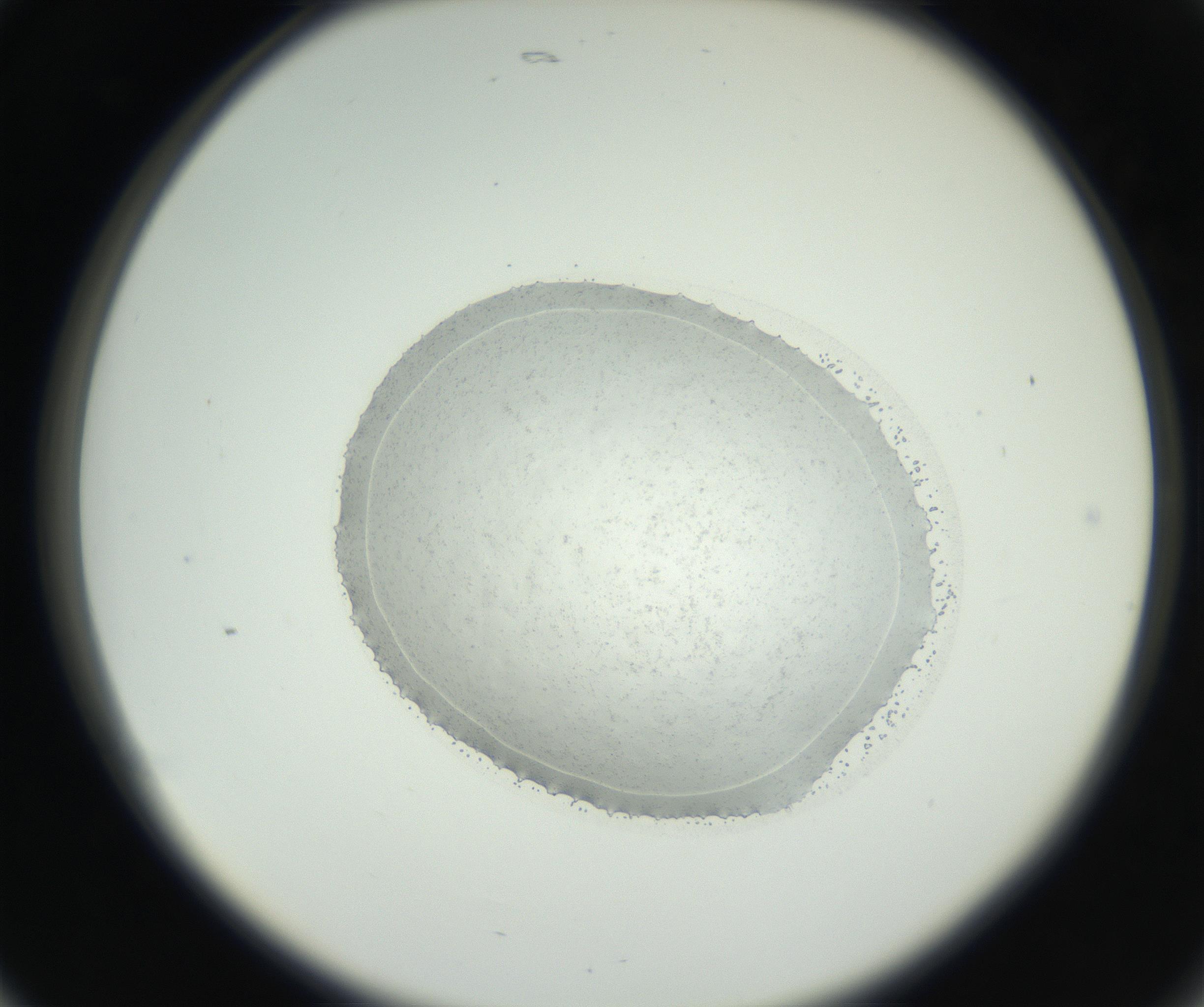 RI01_03_000_0212_Proj1_Clon1_MC_0000MC102667_004_160828_05_02_02_00_99_002_001_RAI.jpg
