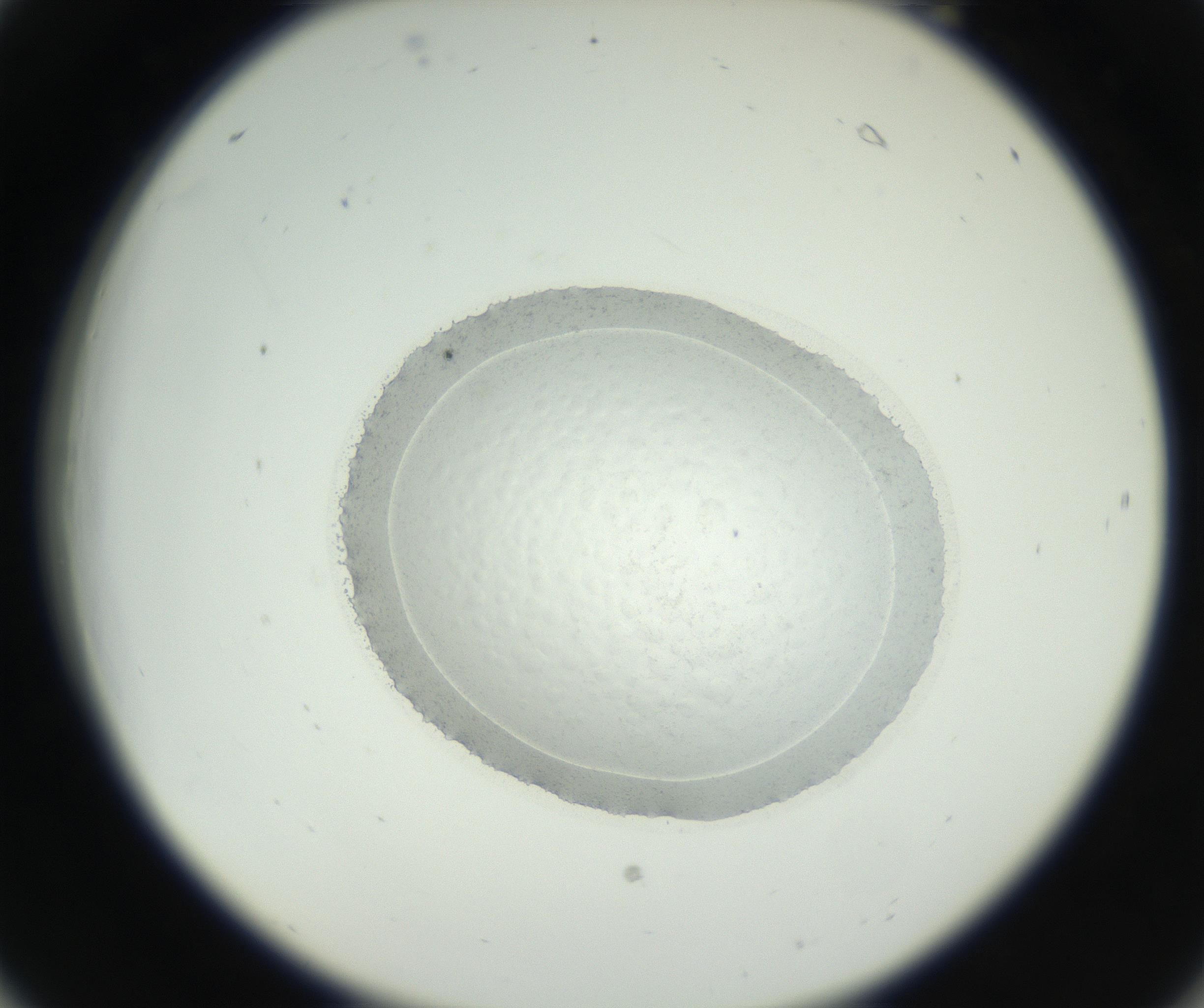 RI01_03_000_0212_Proj1_Clon1_MC_0000MC102667_004_160828_06_02_02_00_99_002_001_RAI.jpg