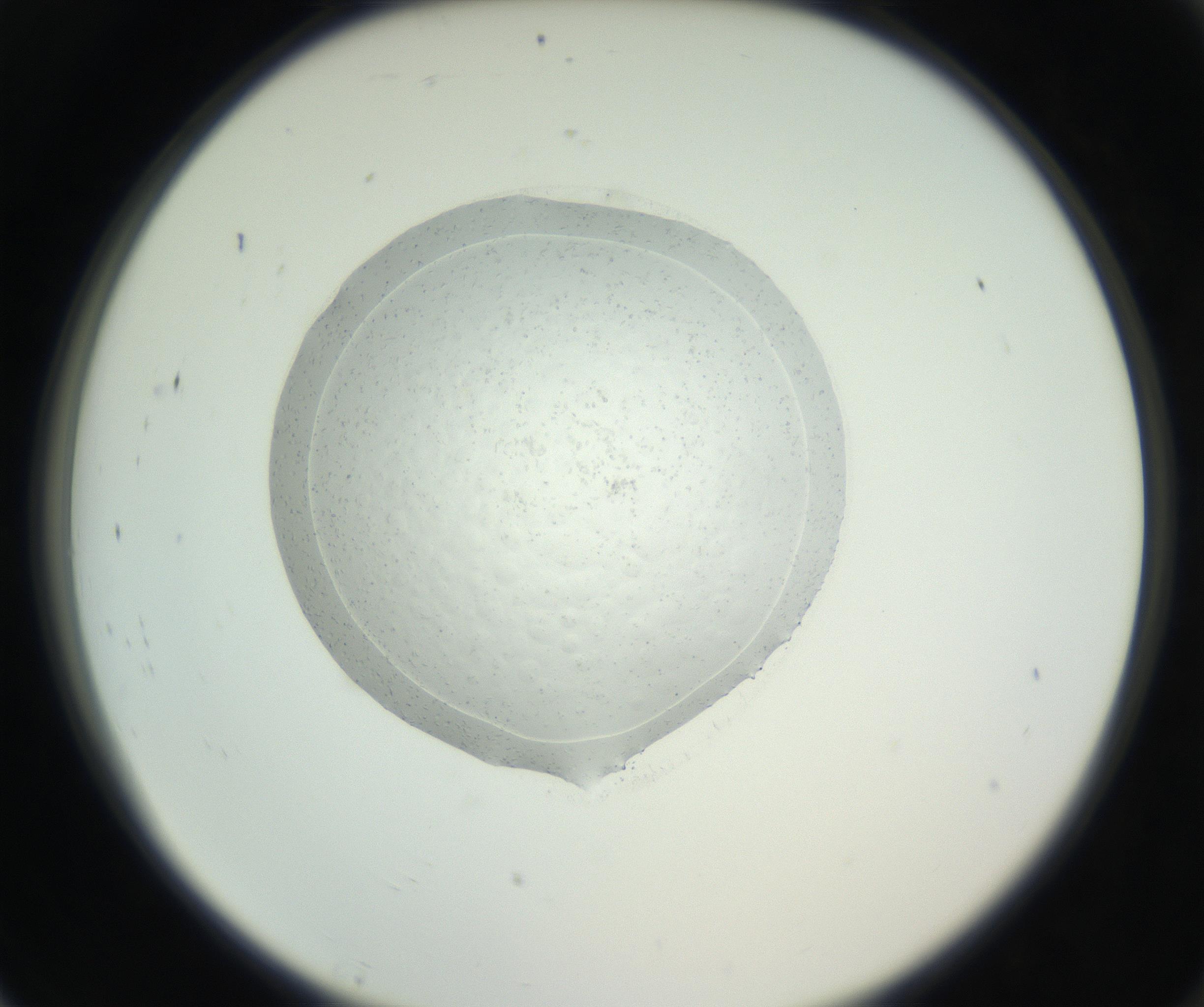 RI01_03_000_0212_Proj1_Clon1_MC_0000MC102667_004_160828_07_08_02_00_99_002_001_RAI.jpg