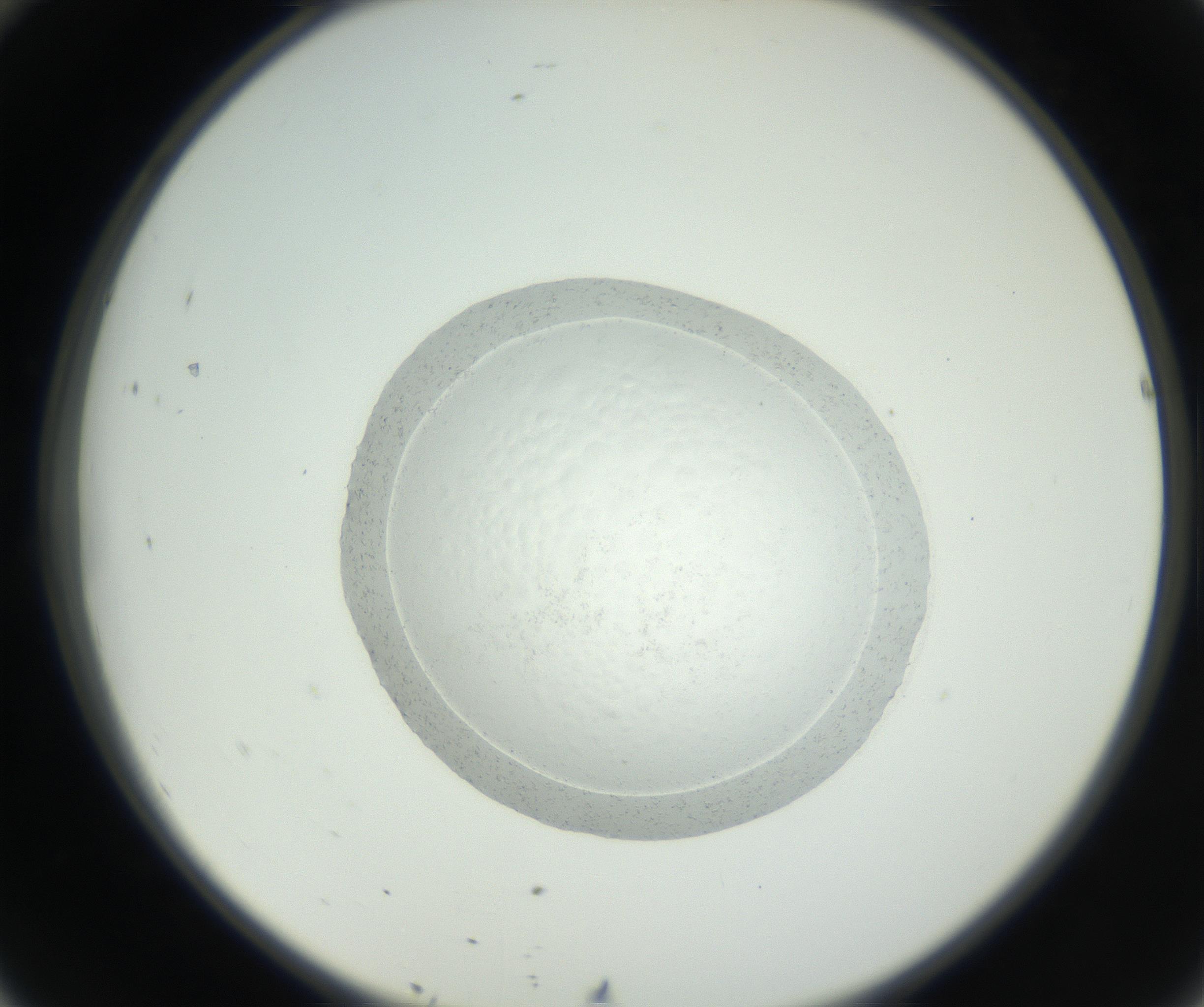 RI01_03_000_0212_Proj1_Clon1_MC_0000MC102667_004_160828_10_04_02_00_99_002_001_RAI.jpg