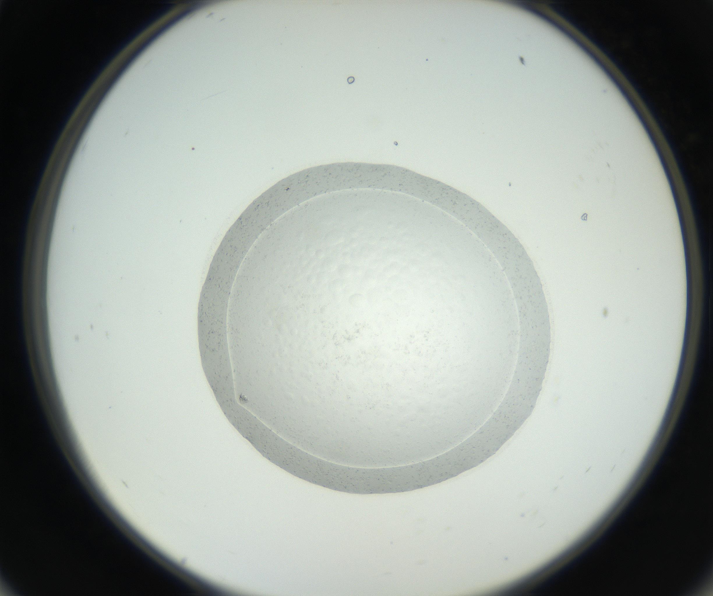RI01_03_000_0212_Proj1_Clon1_MC_0000MC102667_004_160828_11_05_02_00_99_002_001_RAI.jpg