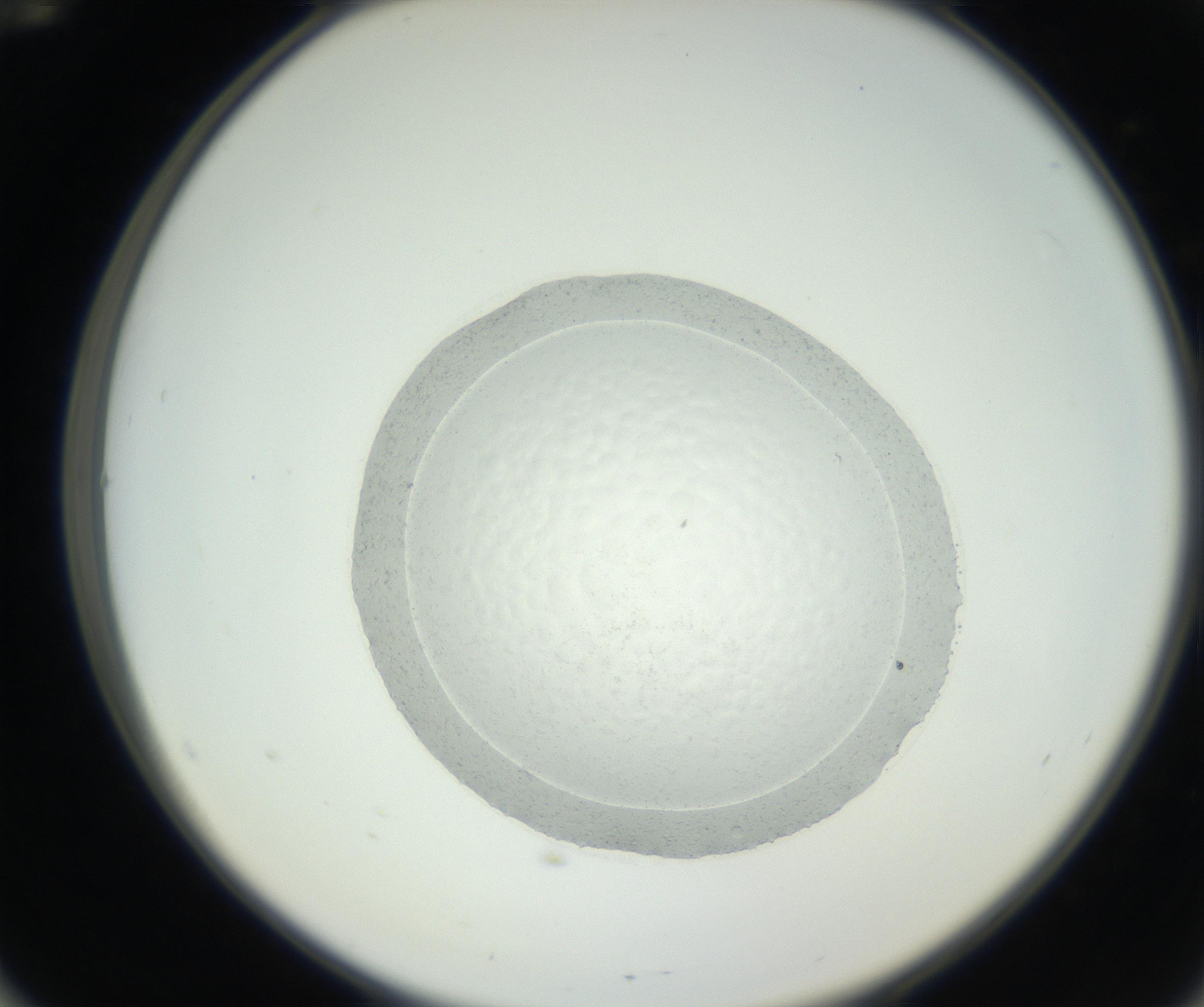 RI01_03_000_0212_Proj1_Clon1_MC_0000MC102667_004_160828_12_05_02_00_99_002_001_RAI.jpg