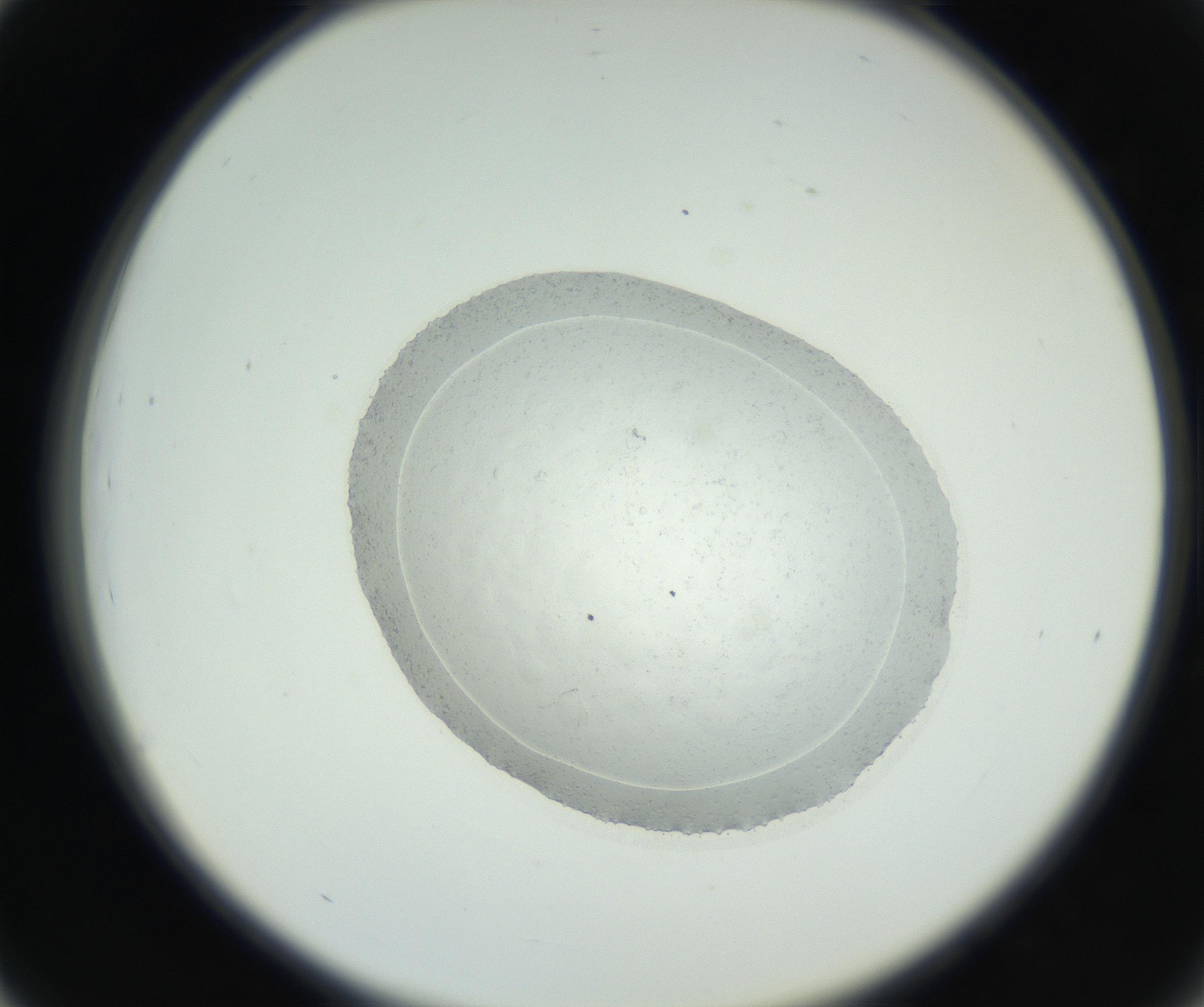 RI01_03_000_0212_Proj1_Clon1_MC_0000MC102667_005_160830_03_04_02_00_99_002_001_RAI.jpg