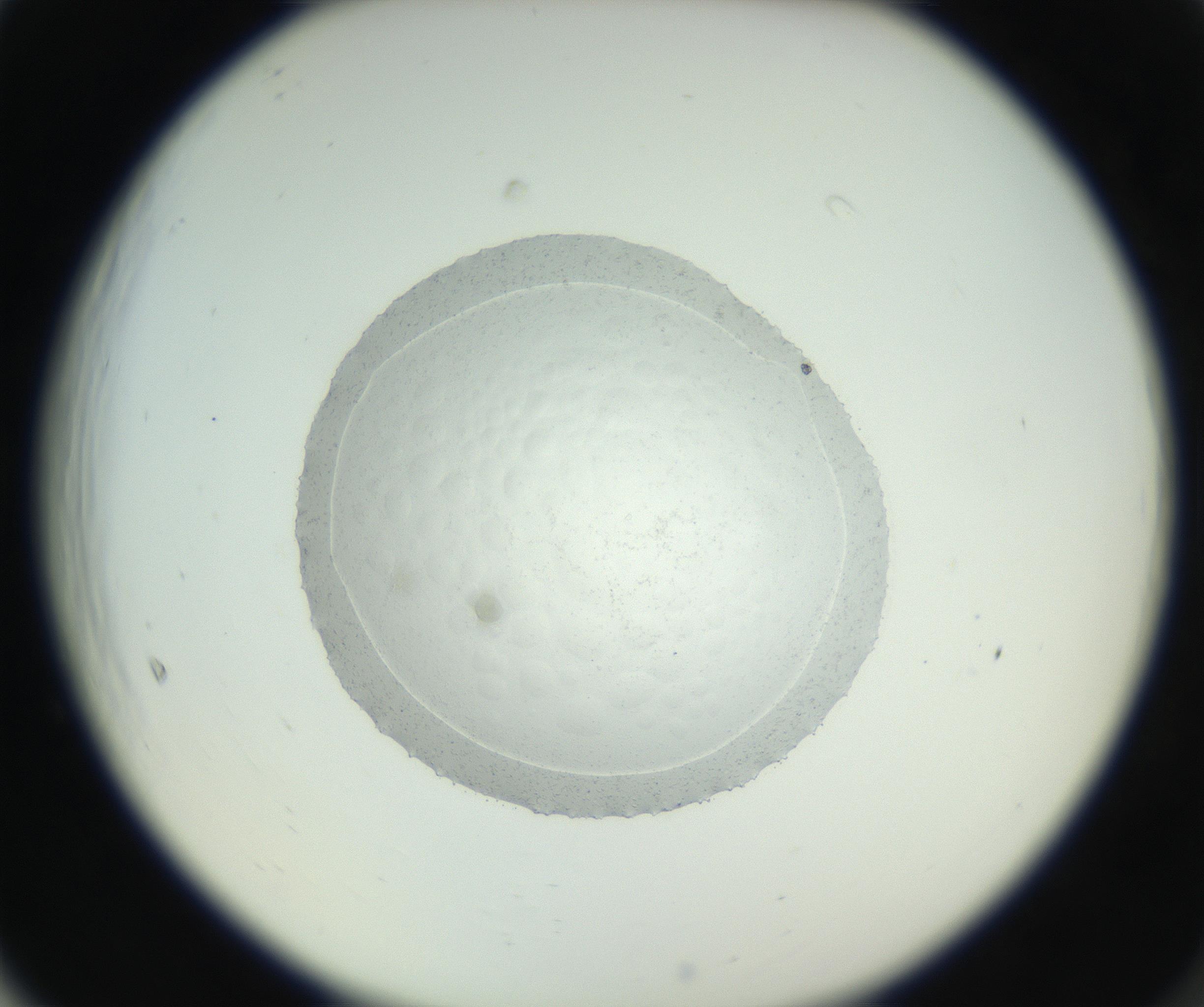 RI01_03_000_0212_Proj1_Clon1_MC_0000MC102667_005_160830_05_06_02_00_99_002_001_RAI.jpg