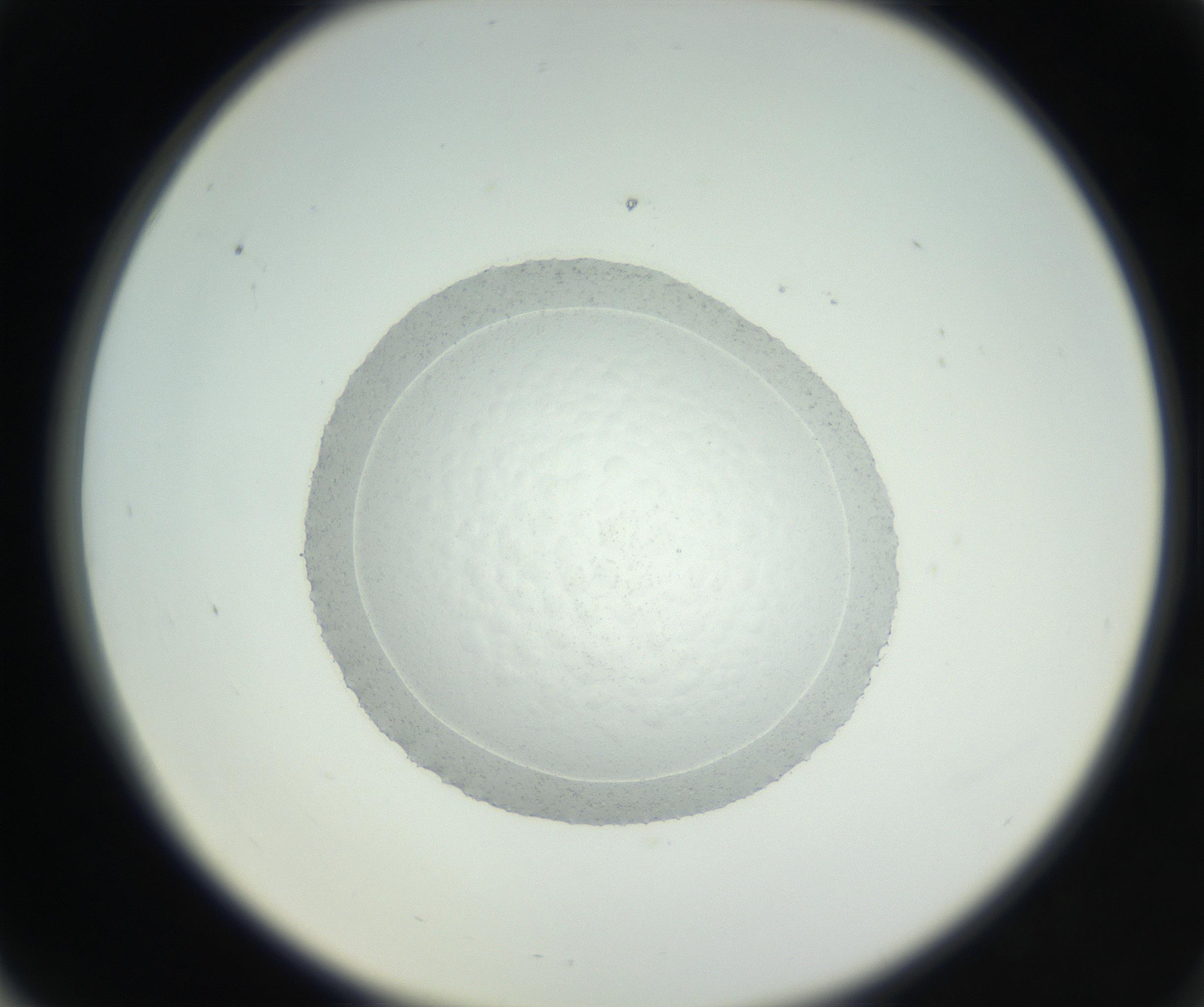 RI01_03_000_0212_Proj1_Clon1_MC_0000MC102667_005_160830_06_06_02_00_99_002_001_RAI.jpg