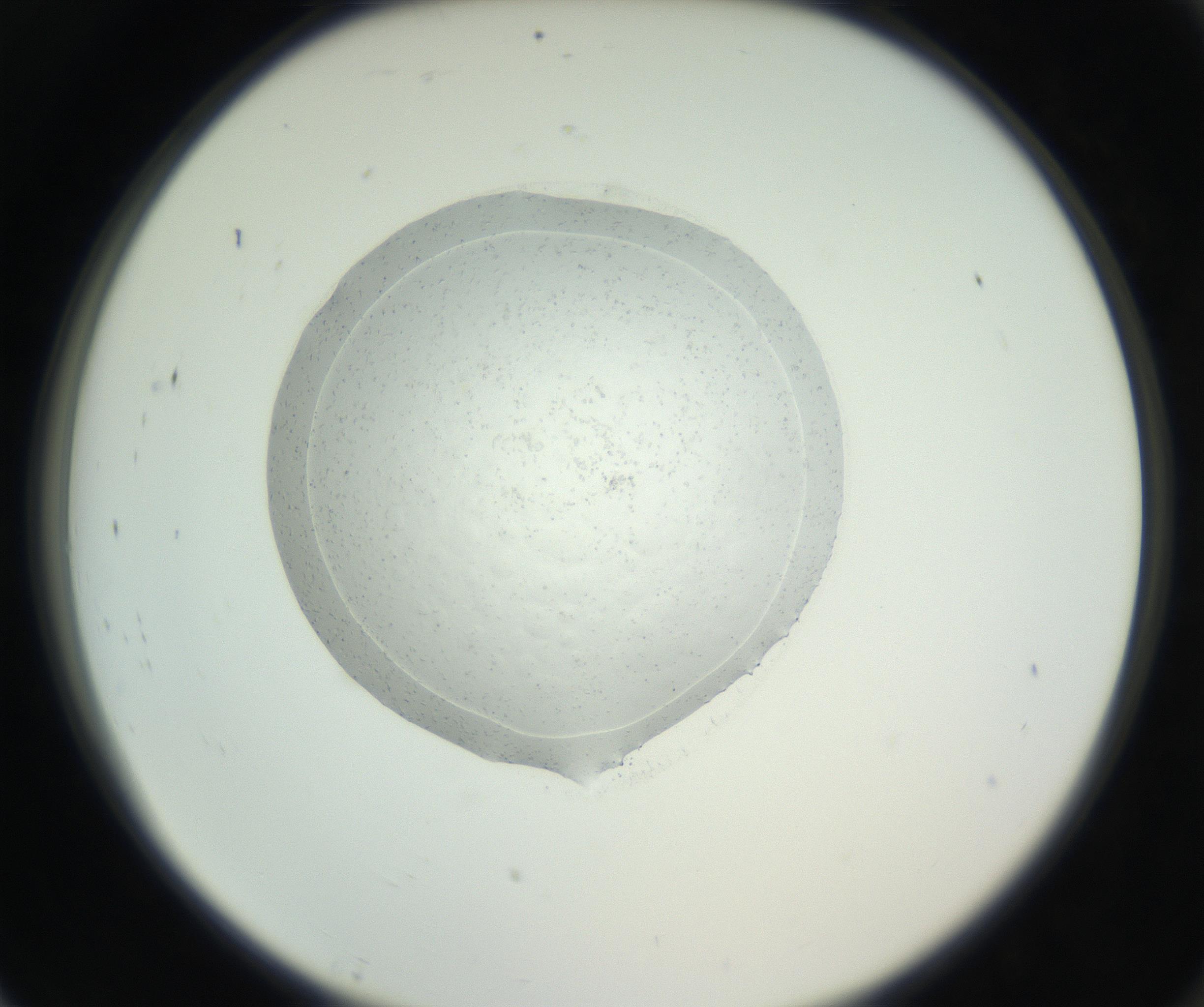 RI01_03_000_0212_Proj1_Clon1_MC_0000MC102667_005_160830_07_08_02_00_99_002_001_RAI.jpg