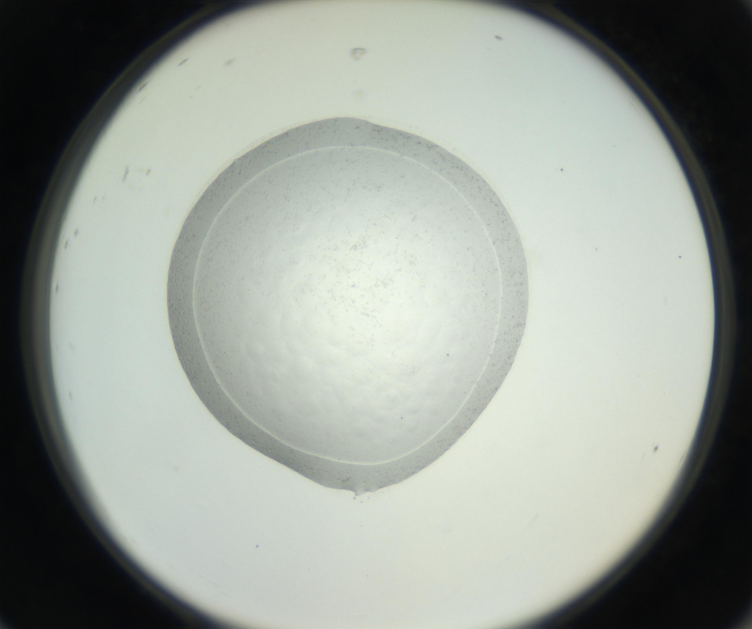 RI01_03_000_0212_Proj1_Clon1_MC_0000MC102667_005_160830_08_08_02_00_99_002_001_RAI.jpg