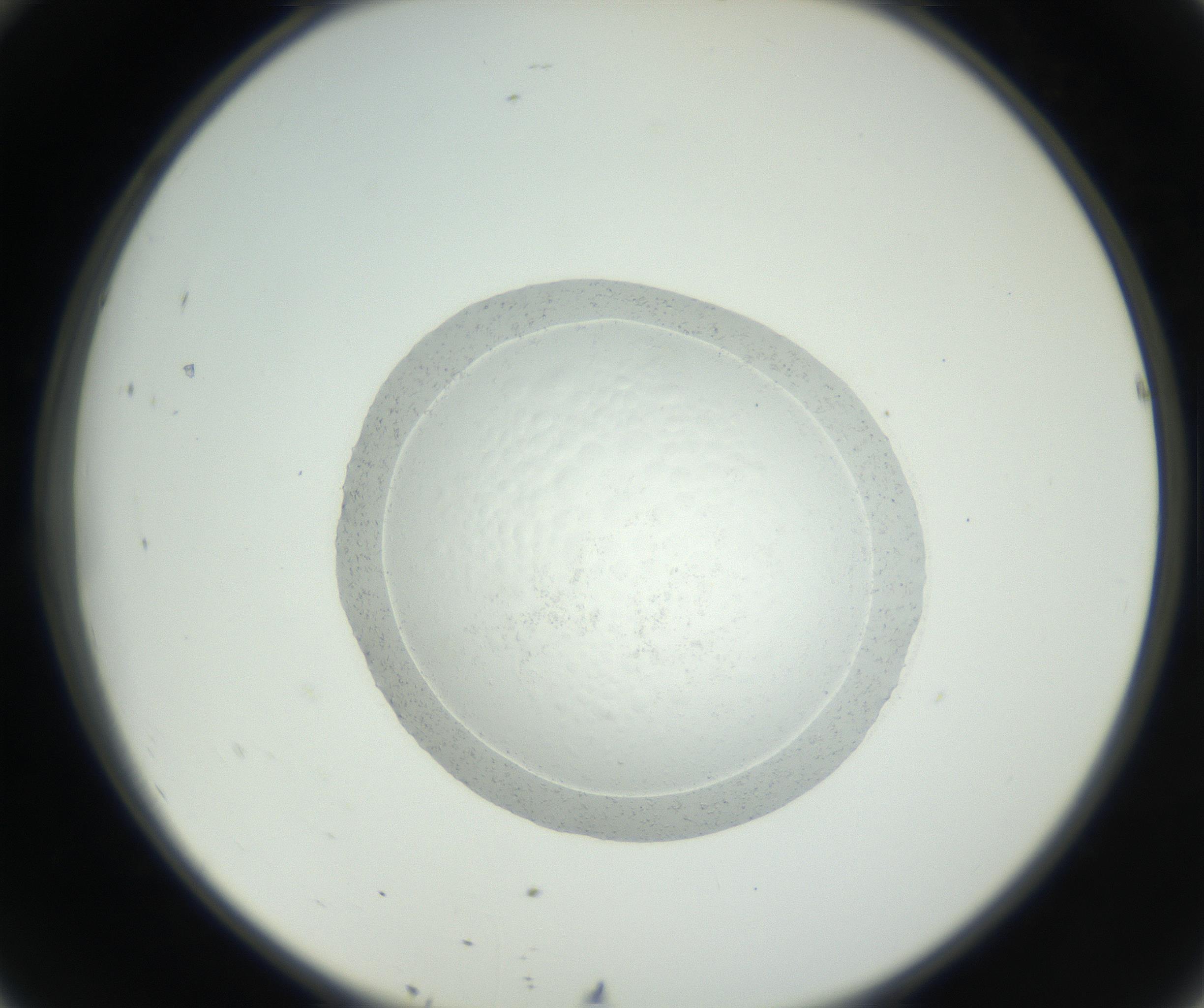 RI01_03_000_0212_Proj1_Clon1_MC_0000MC102667_005_160830_10_04_02_00_99_002_001_RAI.jpg