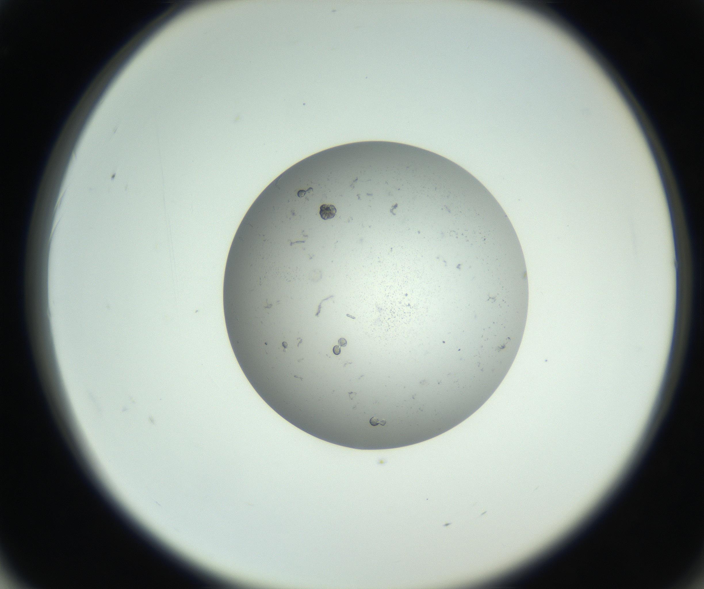 RI01_03_000_0212_Proj1_Clon1_MC_0000MC102726_006_160924_02_06_02_00_99_002_001_RAI.jpg