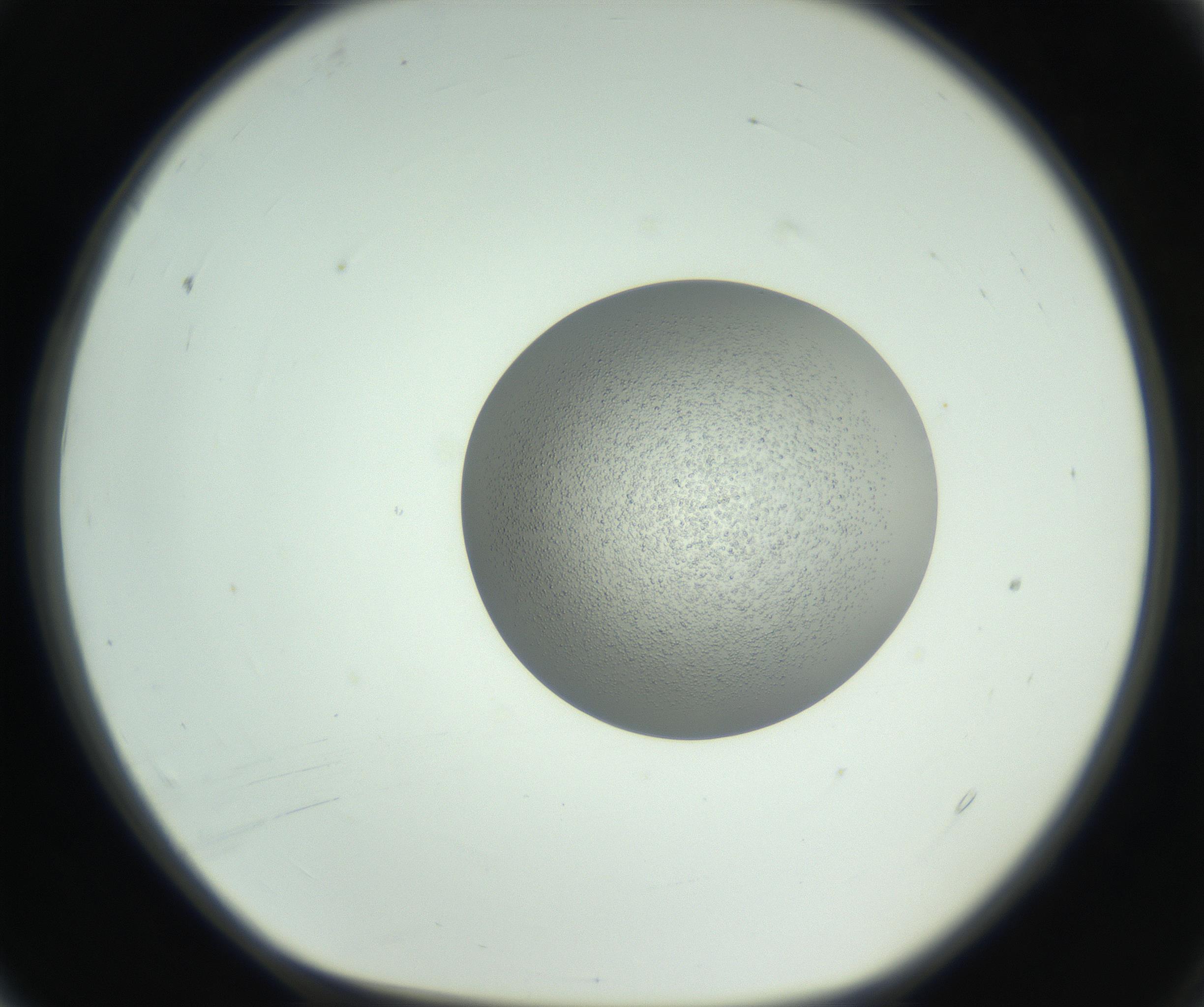 RI01_03_000_0212_Proj1_Clon1_MC_0000MC102746_005_160927_04_01_01_00_99_002_001_RAI.jpg
