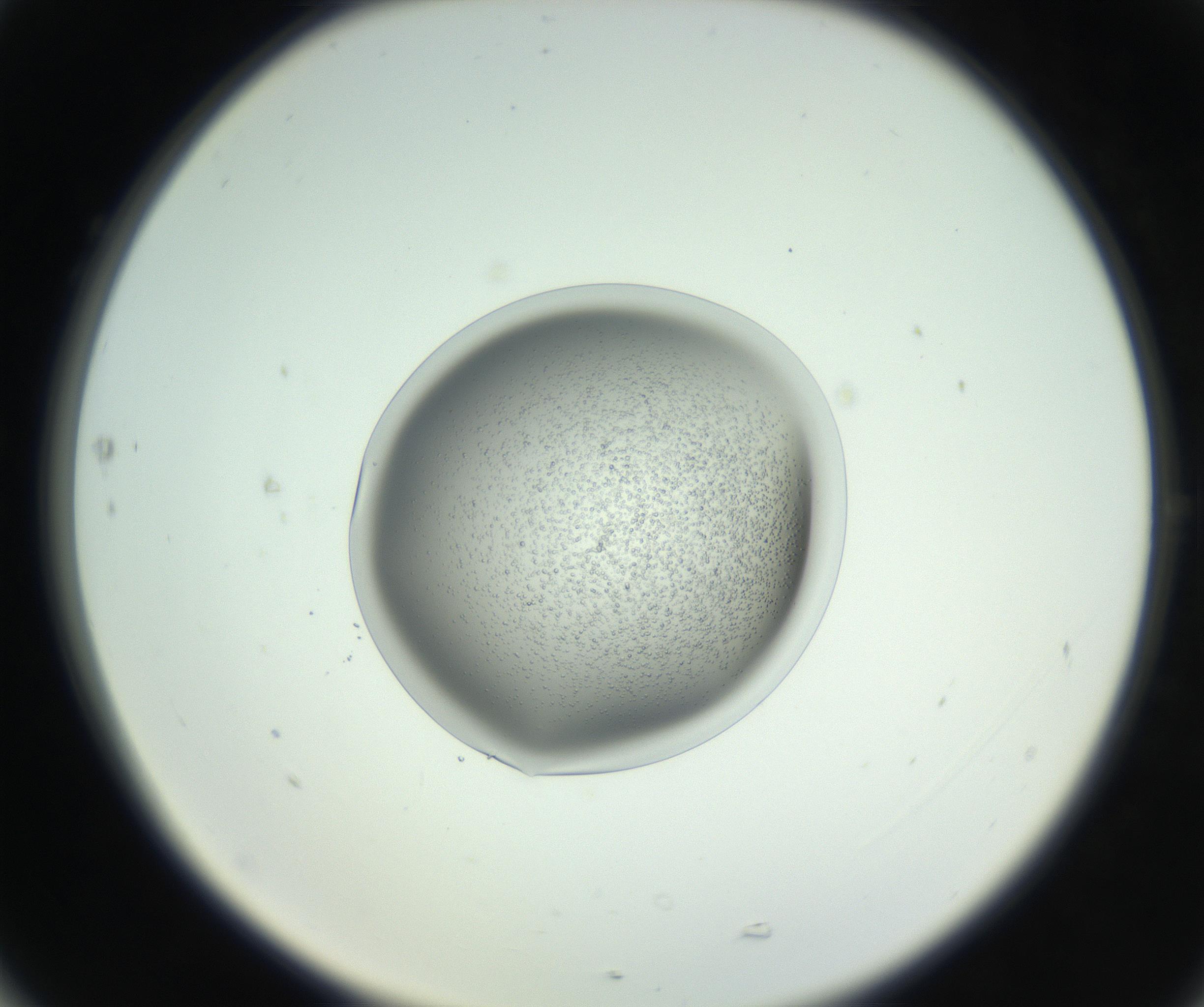 RI01_03_000_0212_Proj1_Clon1_MC_0000MC102746_005_160927_05_07_02_00_99_002_001_RAI.jpg
