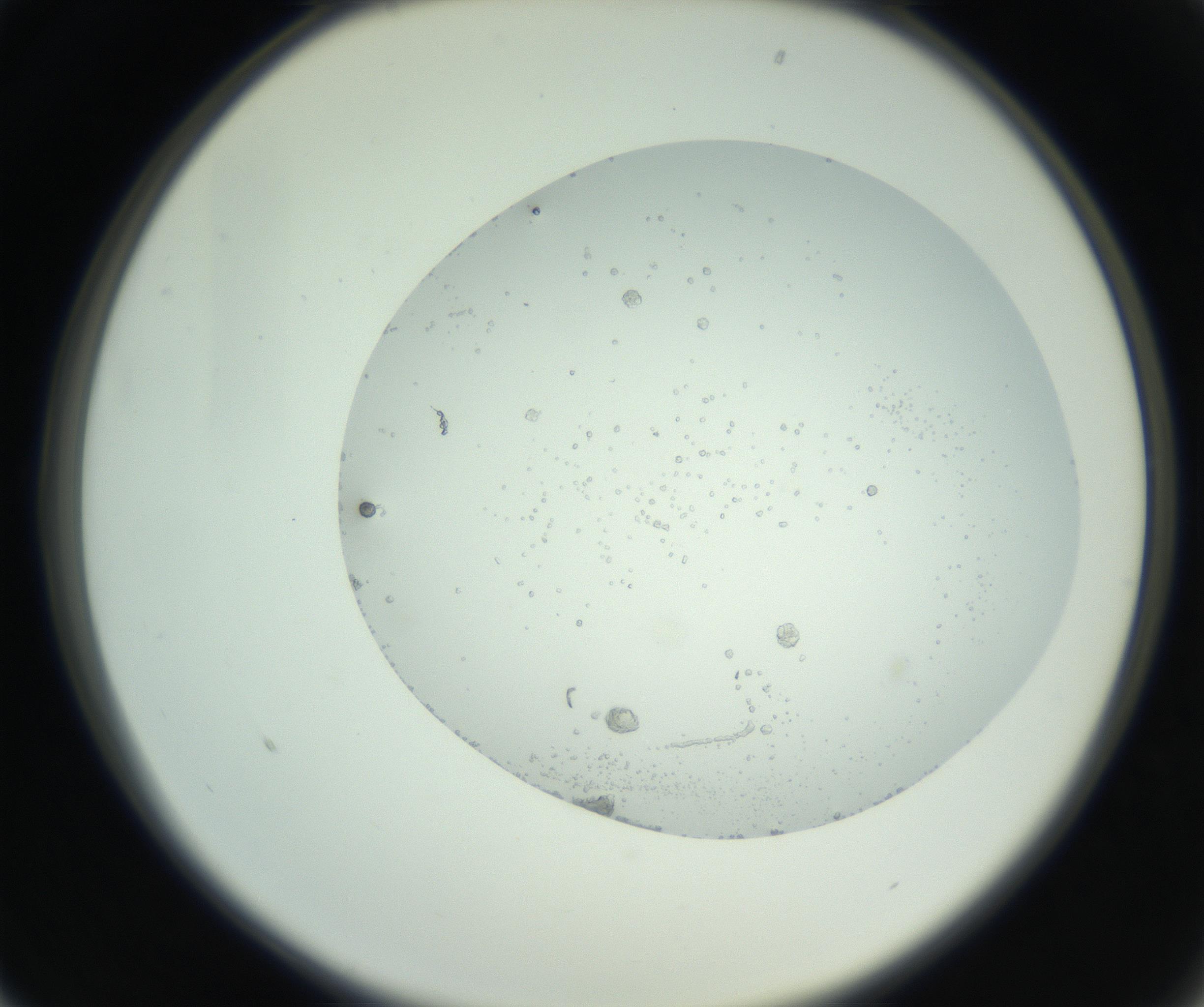 RI01_03_000_0212_Proj1_Clon1_MC_0000MC102749_005_160930_01_02_02_00_99_002_001_RAI.jpg