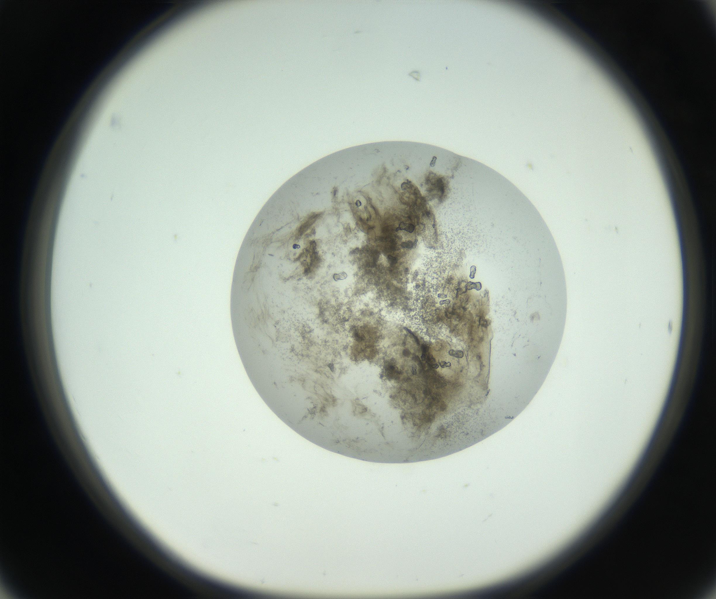 RI01_03_000_0212_Proj1_Clon1_MC_0000MC102749_005_160930_06_04_01_00_99_002_001_RAI.jpg