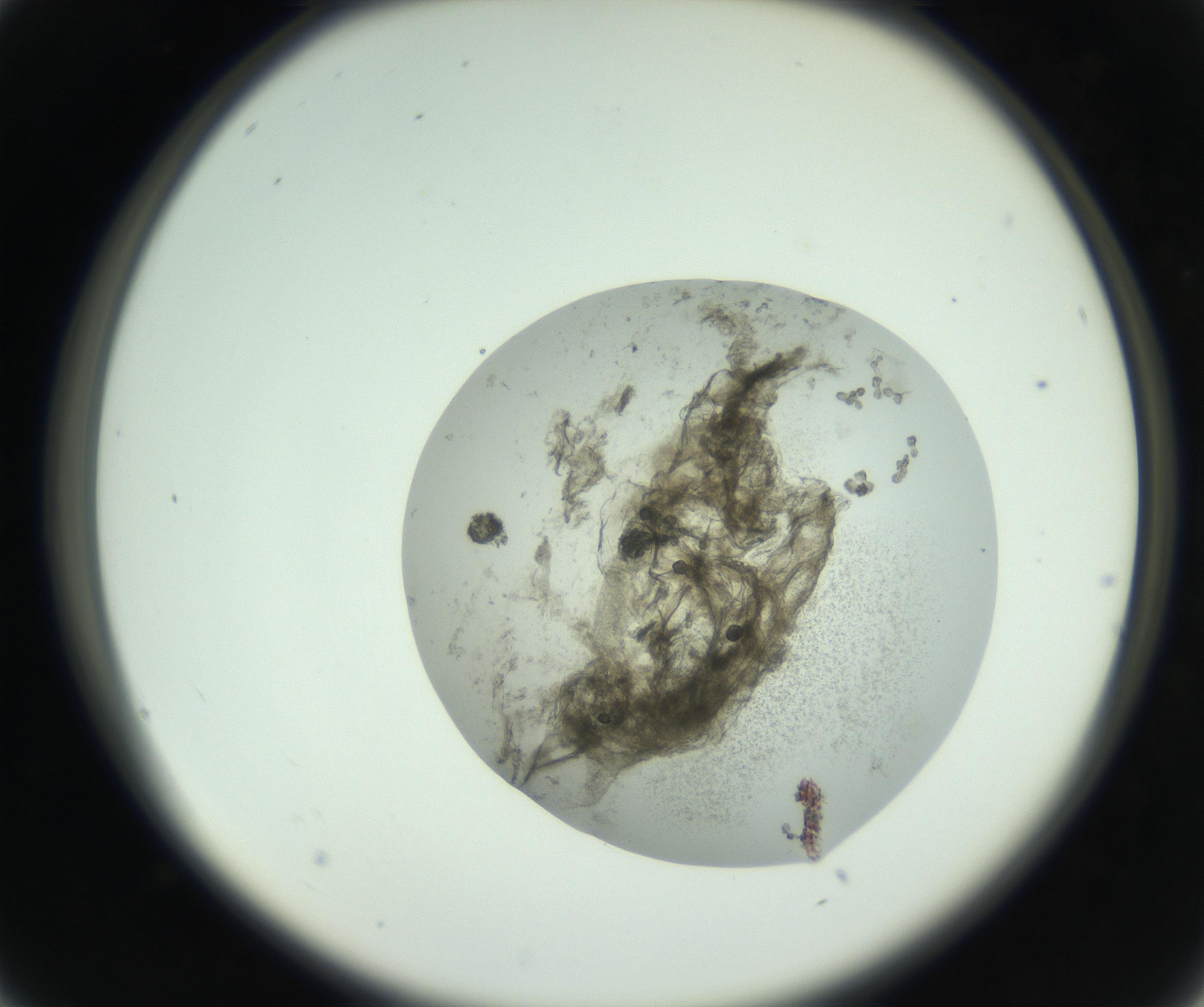 RI01_03_000_0212_Proj1_Clon1_MC_0000MC102798_005_161006_04_02_02_00_99_002_001_RAI.jpg