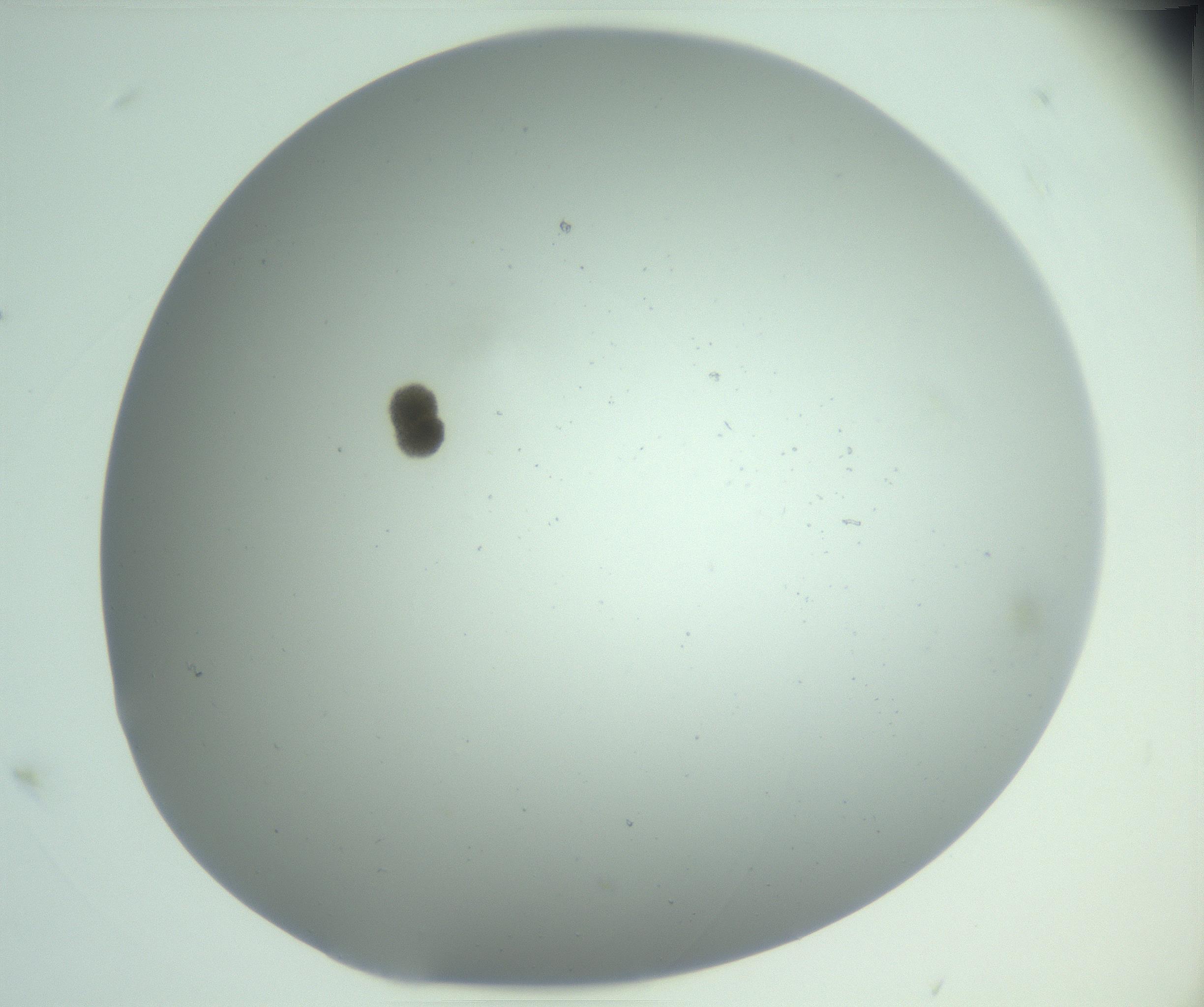 RI01_03_000_0212_Proj1_Clon1_MC_0000MC102890_010_161128_05_06_01_00_99_002_001_RAI.jpg