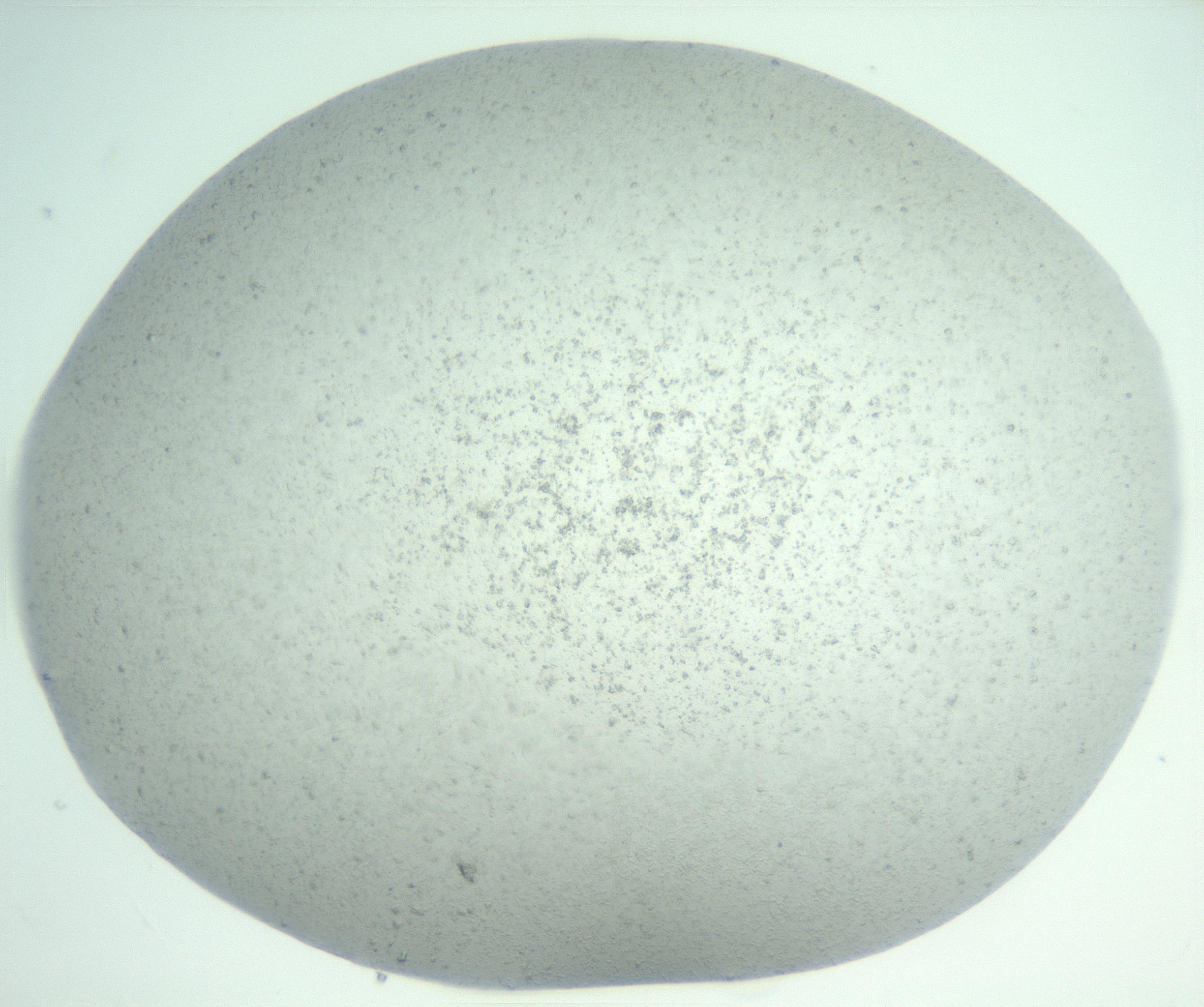 RI01_03_000_0212_Proj1_Clon1_MC_0000MC102943_004_161111_06_07_02_00_99_002_001_RAI.jpg