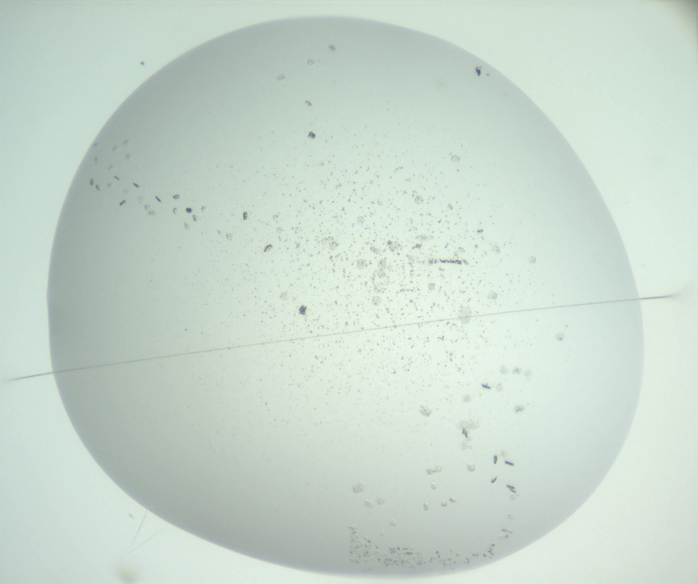 RI01_03_000_0212_Proj1_Clon1_MC_0000MC102956_003_161113_02_01_01_00_99_002_001_RAI.jpg