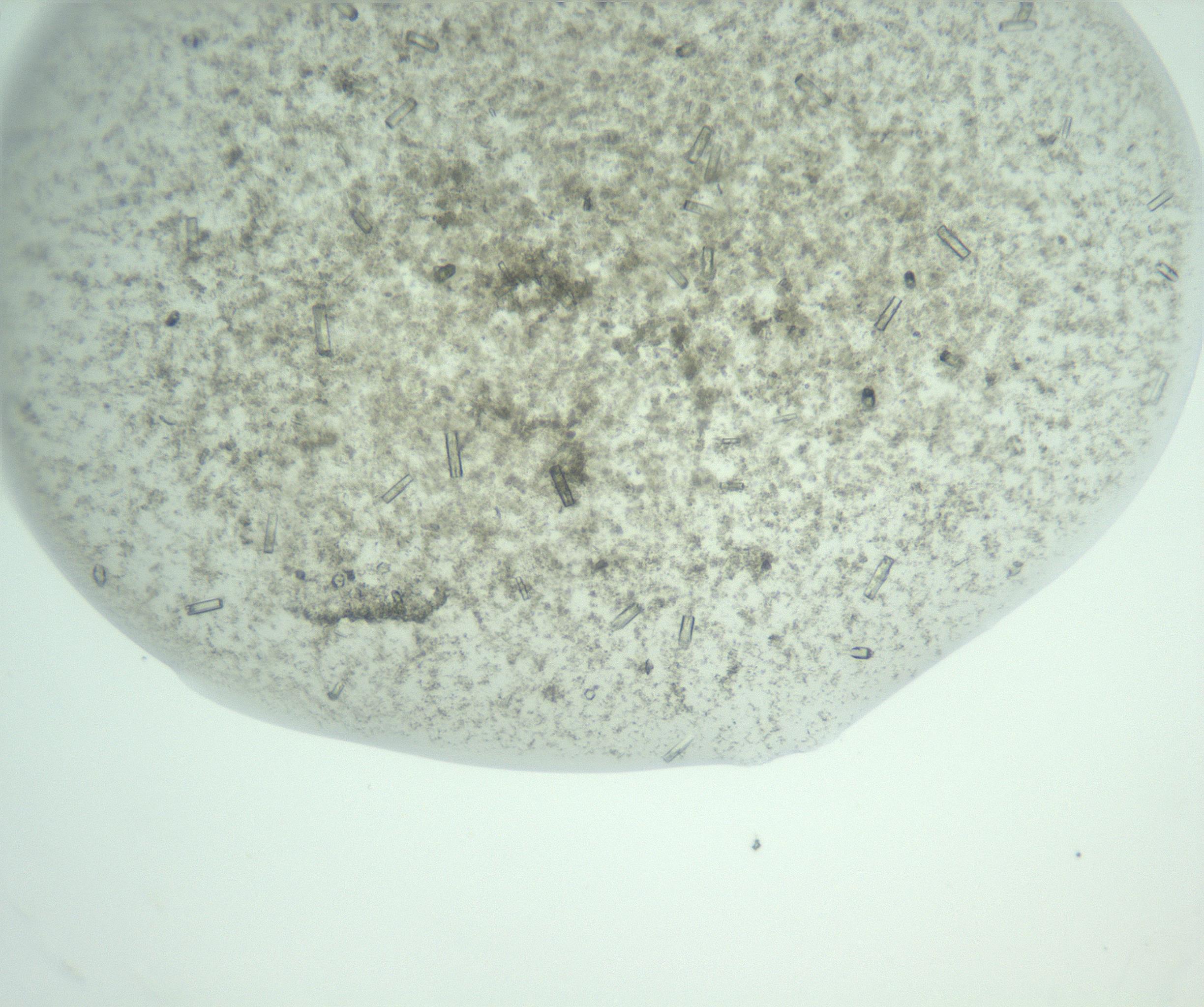 RI01_03_000_0212_Proj1_Clon1_MC_0000MC102956_006_161120_07_08_01_00_99_002_001_RAI.jpg