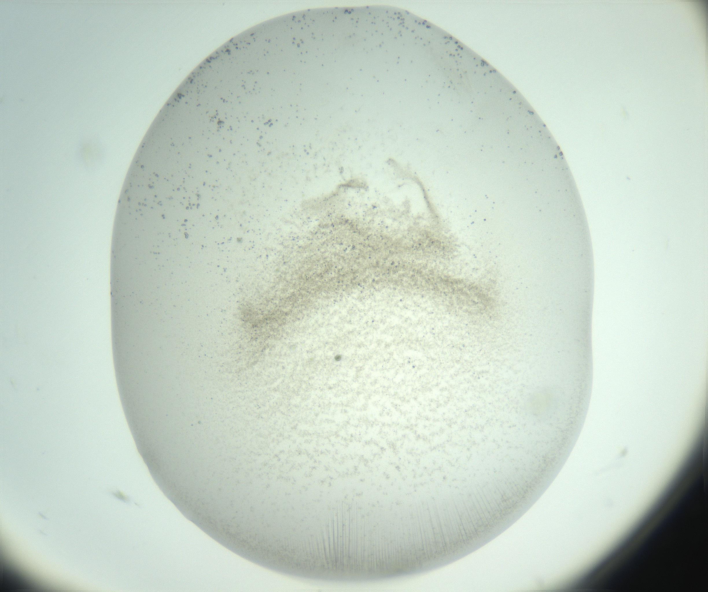 RI01_03_000_0212_Proj1_Clon1_MC_0000MC103007_002_161119_11_04_02_00_99_002_001_RAI.jpg