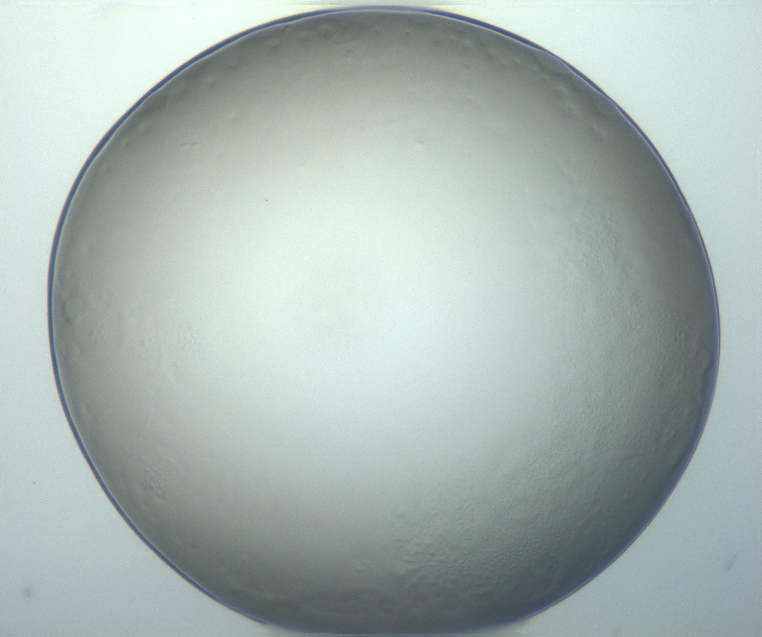 RI01_03_000_0212_Proj1_Clon1_MC_0000MC103014_003_161122_03_06_01_00_99_002_001_RAI.jpg