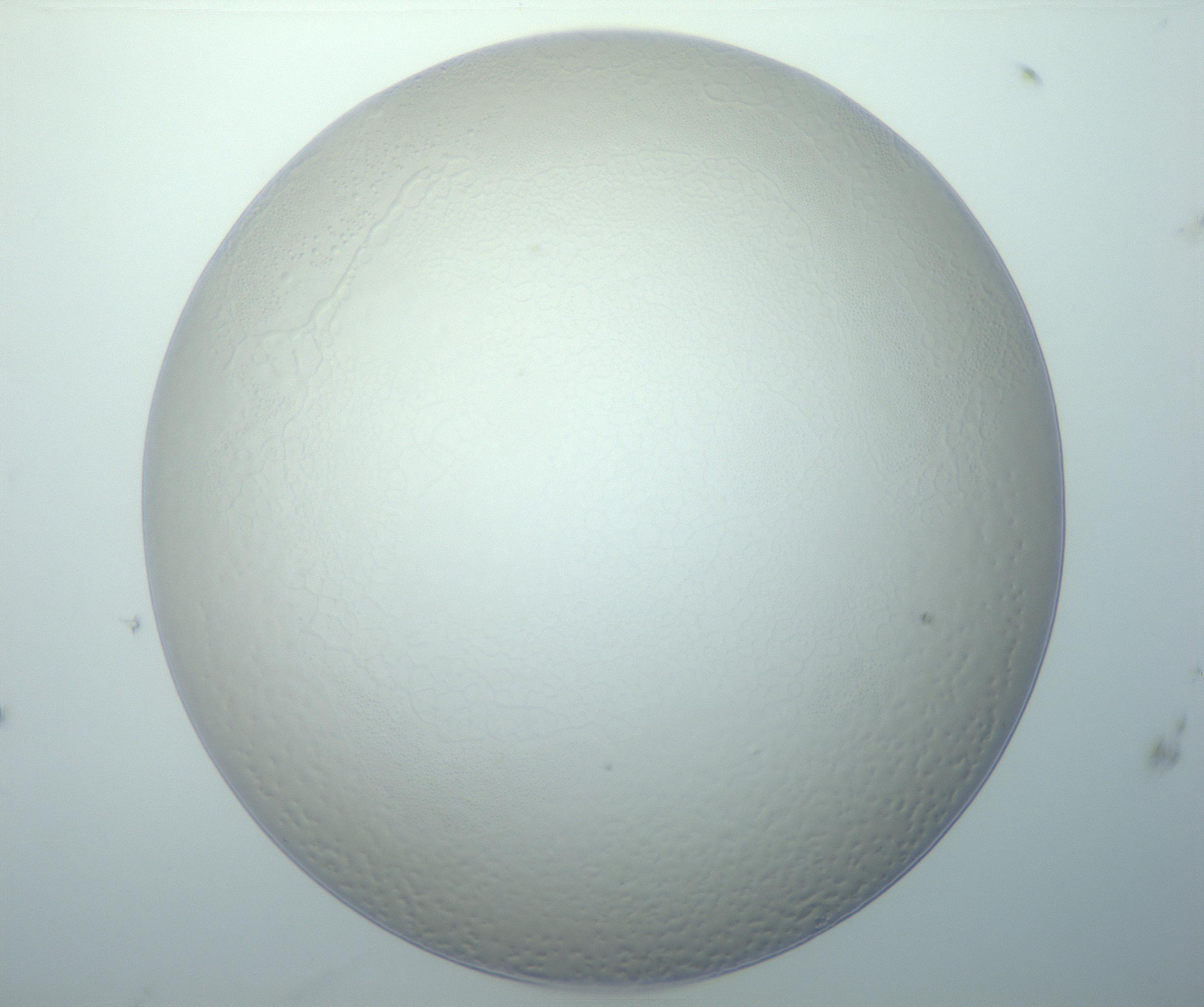 RI01_03_000_0212_Proj1_Clon1_MC_0000MC103014_003_161122_11_06_01_00_99_002_001_RAI.jpg