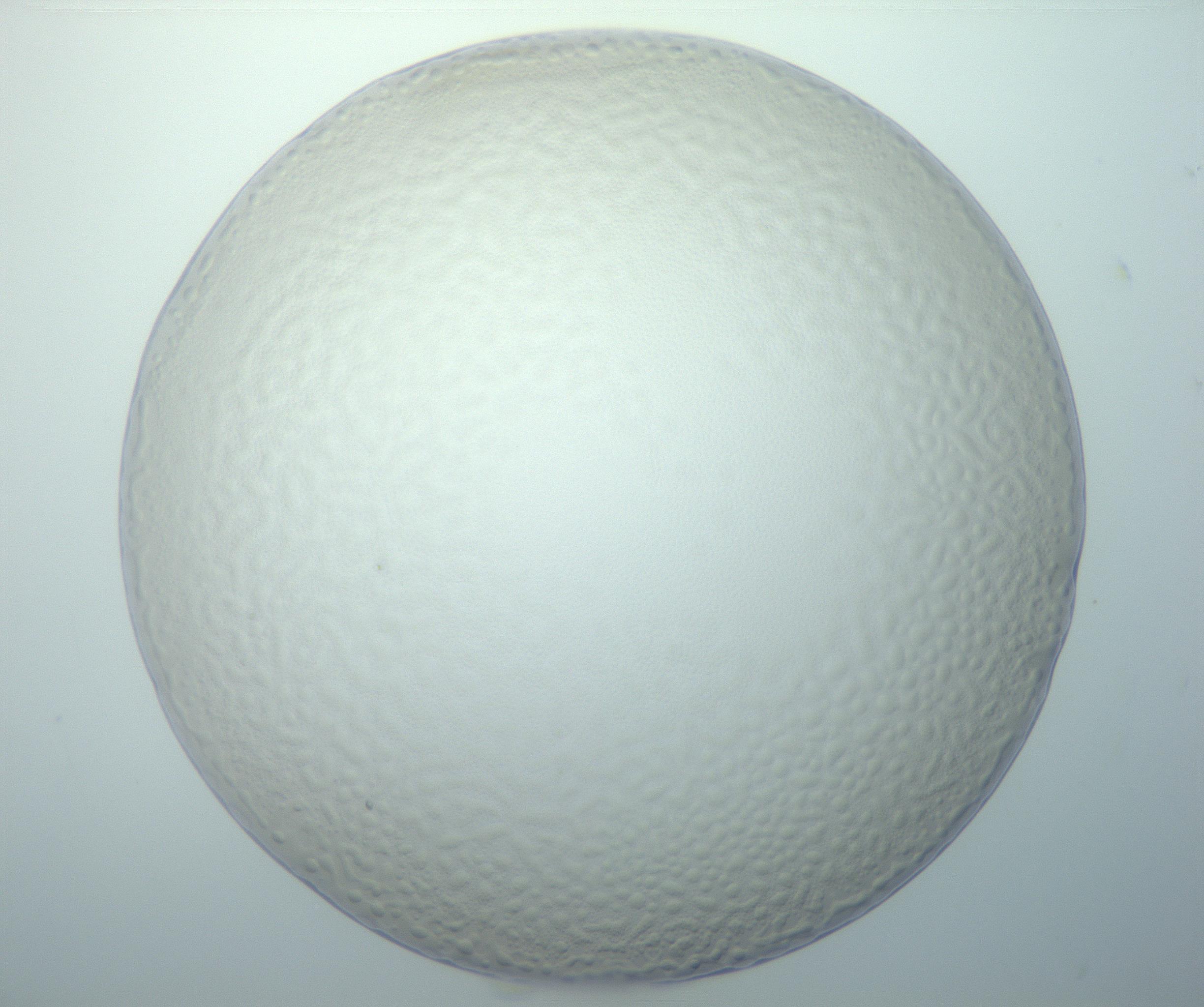 RI01_03_000_0212_Proj1_Clon1_MC_0000MC103014_003_161122_11_07_01_00_99_002_001_RAI.jpg