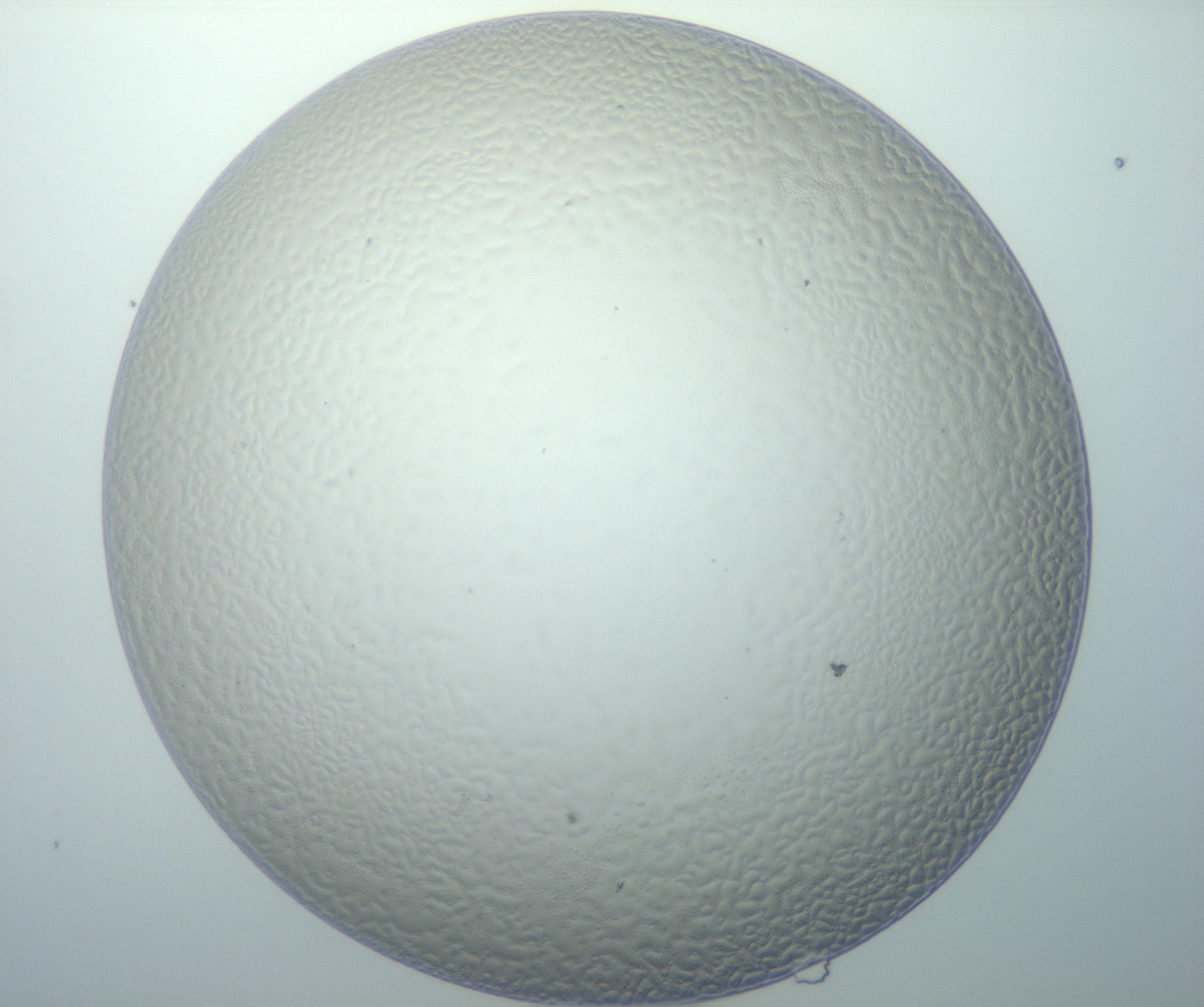 RI01_03_000_0212_Proj1_Clon1_MC_0000MC103014_003_161122_12_04_01_00_99_002_001_RAI.jpg