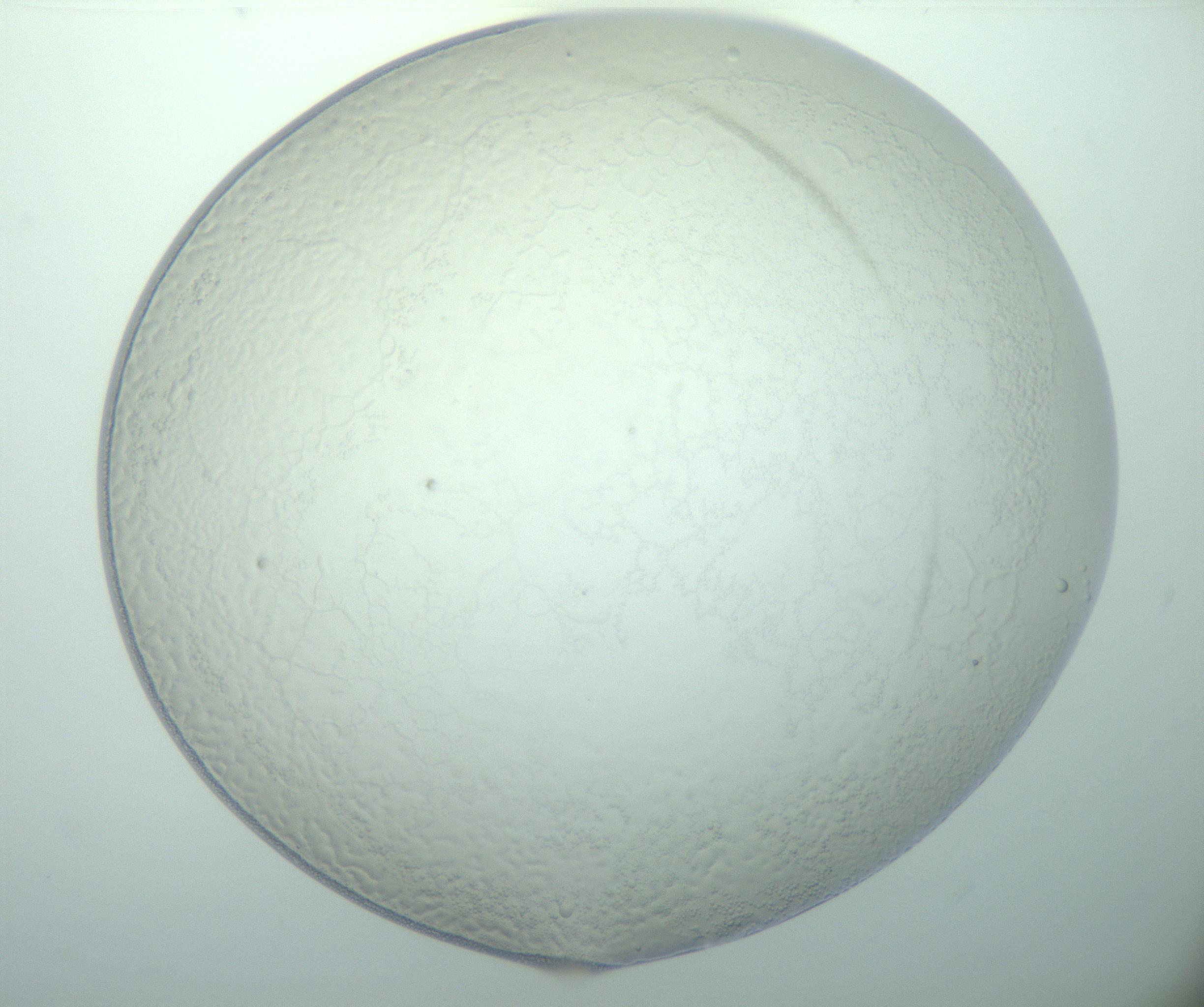 RI01_03_000_0212_Proj1_Clon1_MC_0000MC103015_002_161120_01_07_01_00_99_002_001_RAI.jpg