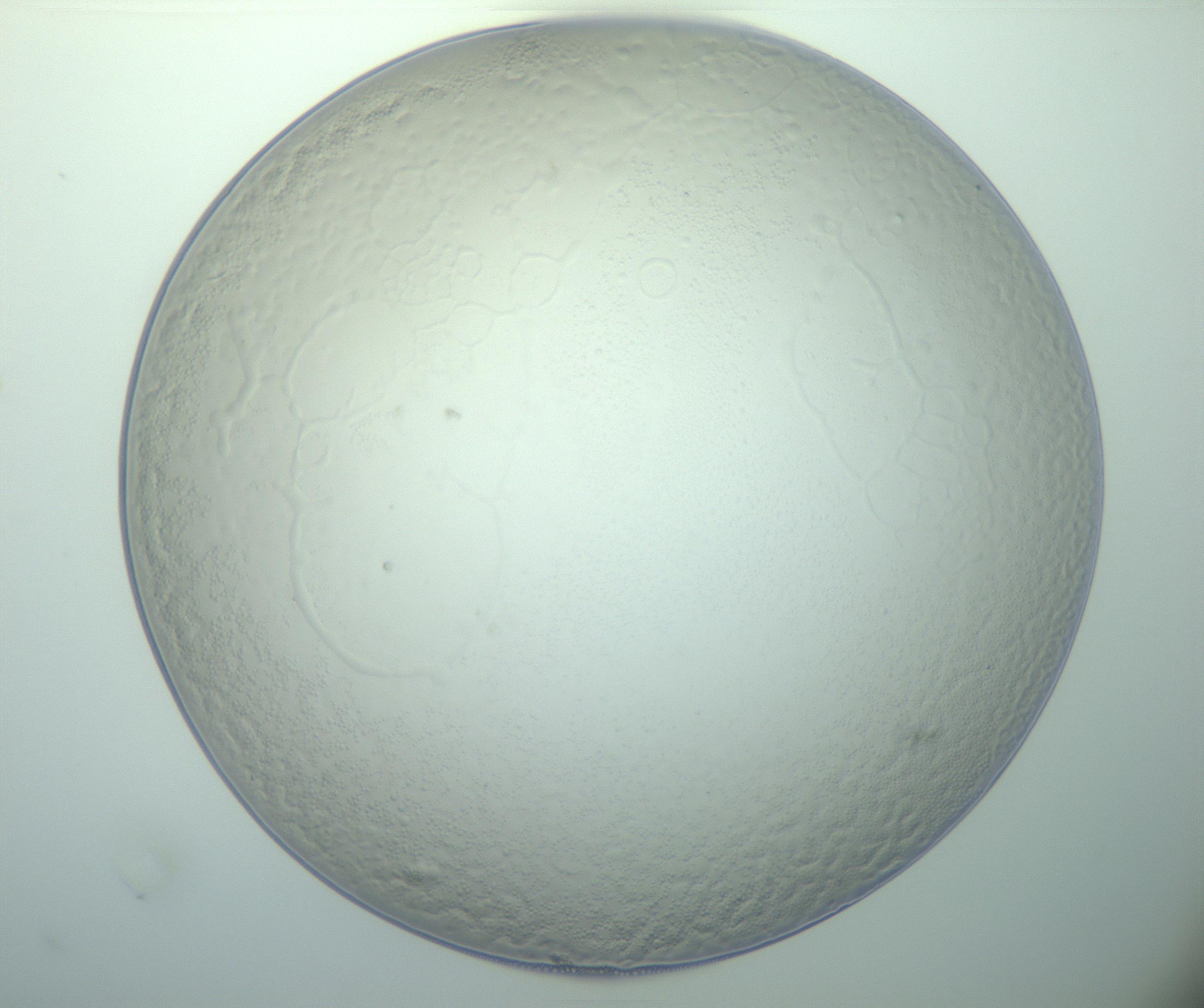 RI01_03_000_0212_Proj1_Clon1_MC_0000MC103015_002_161120_02_03_01_00_99_002_001_RAI.jpg
