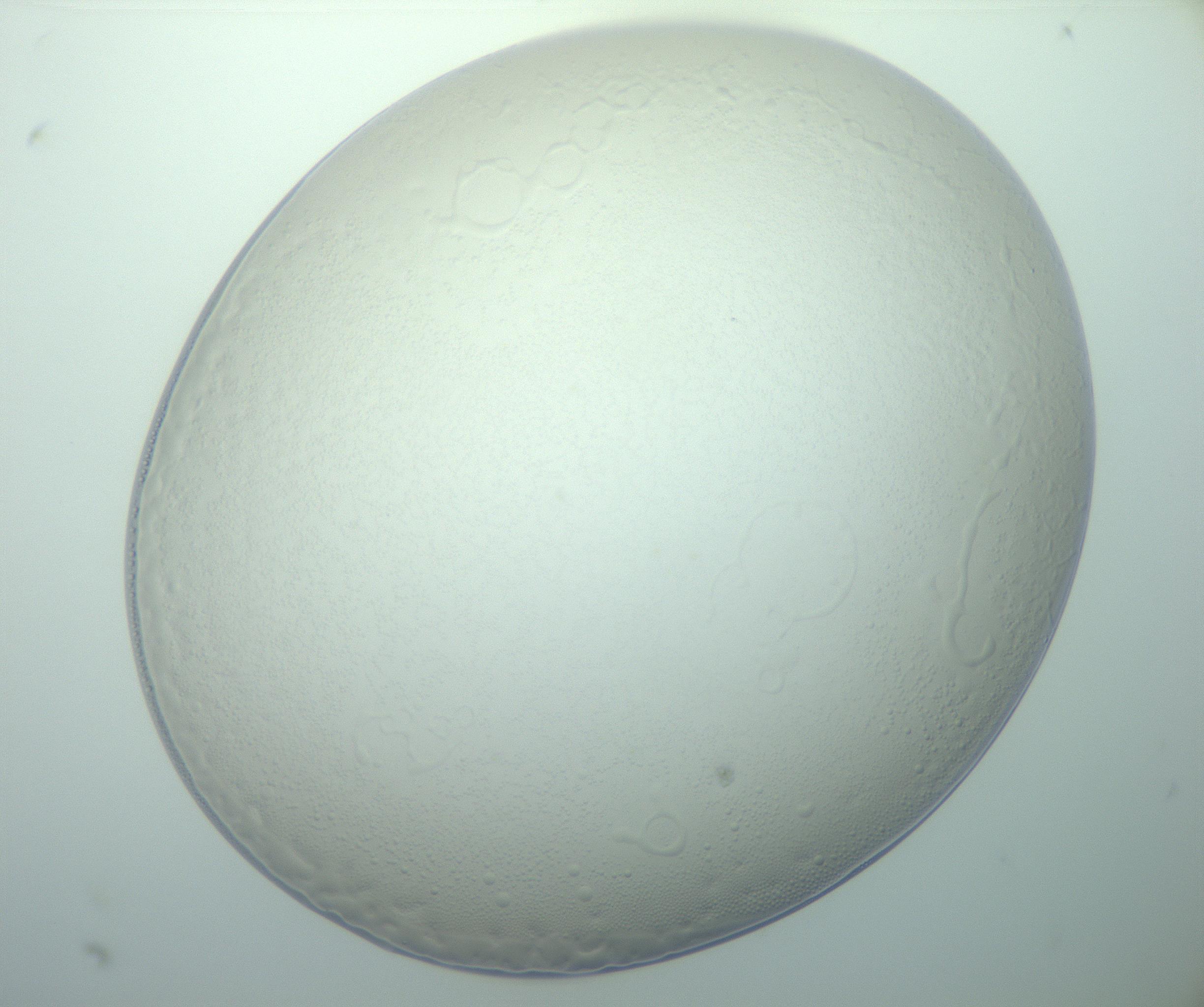 RI01_03_000_0212_Proj1_Clon1_MC_0000MC103015_002_161120_05_08_01_00_99_002_001_RAI.jpg