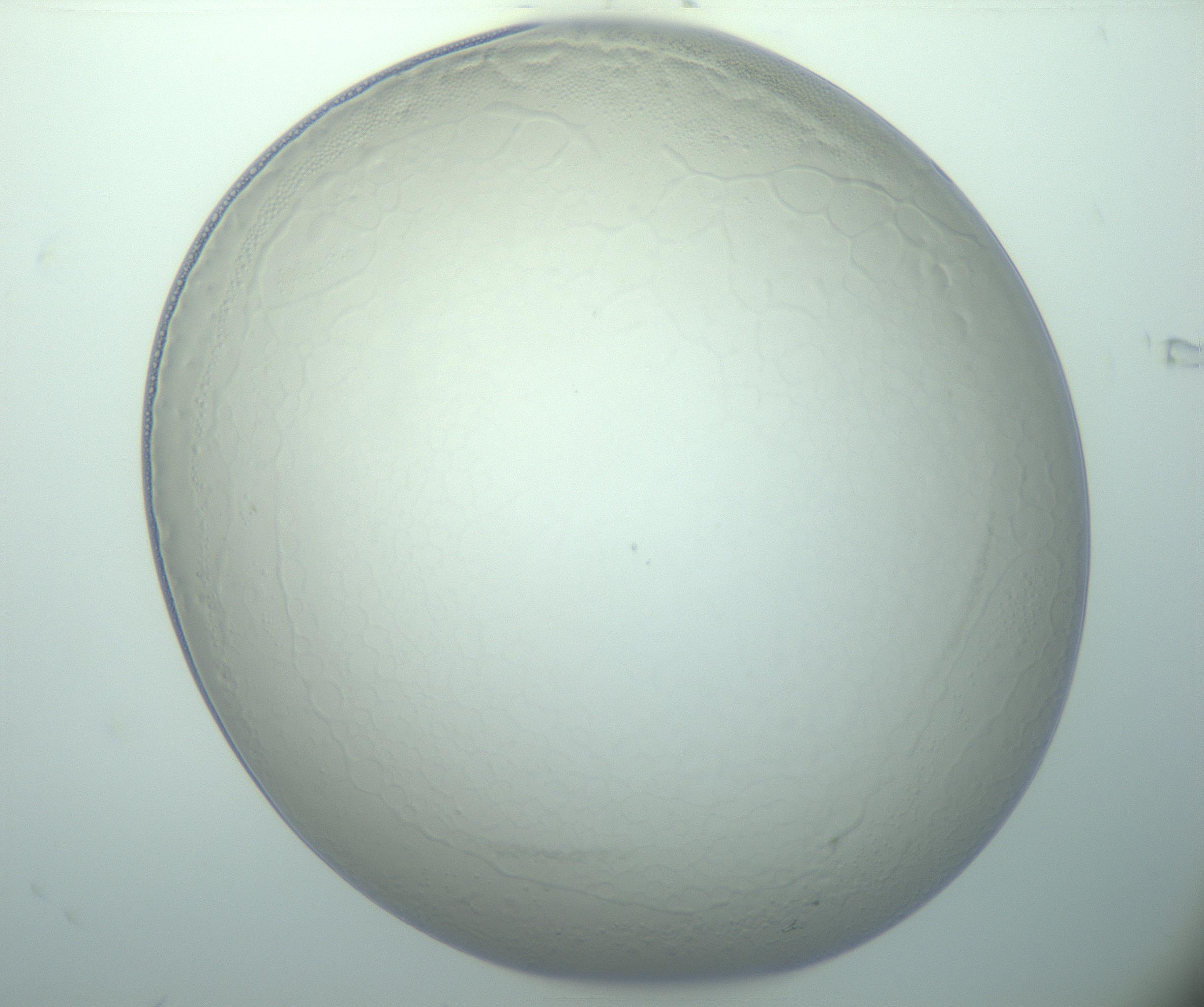 RI01_03_000_0212_Proj1_Clon1_MC_0000MC103015_002_161120_06_01_01_00_99_002_001_RAI.jpg