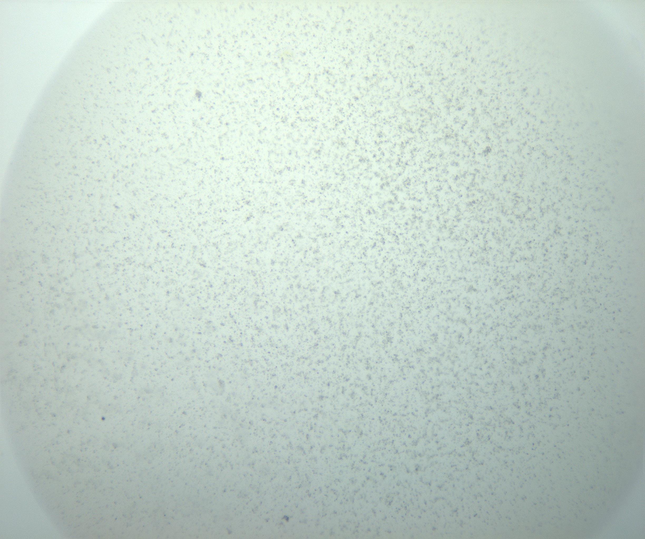 RI01_03_000_0212_Proj1_Clon1_MC_0000MC103015_002_161120_10_06_02_00_99_002_001_RAI.jpg