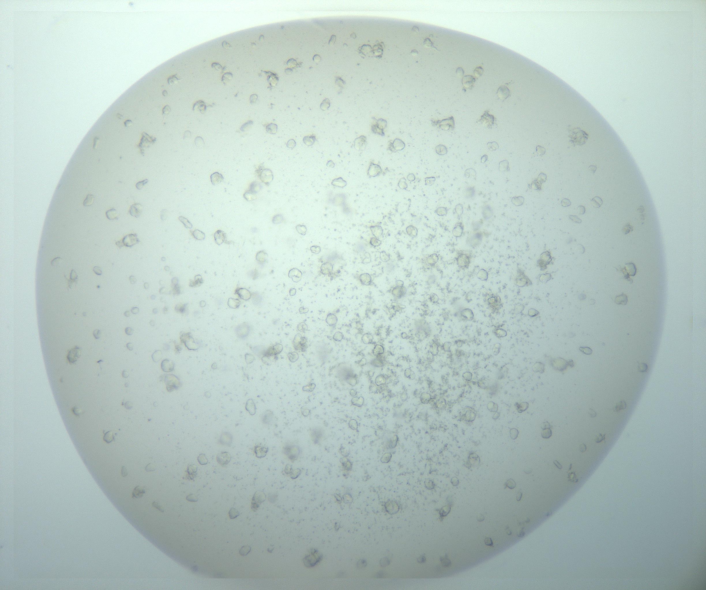 RI01_03_000_0212_Proj1_Clon1_MC_0000MC103018_014_170128_06_02_02_00_99_002_001_RAI.jpg
