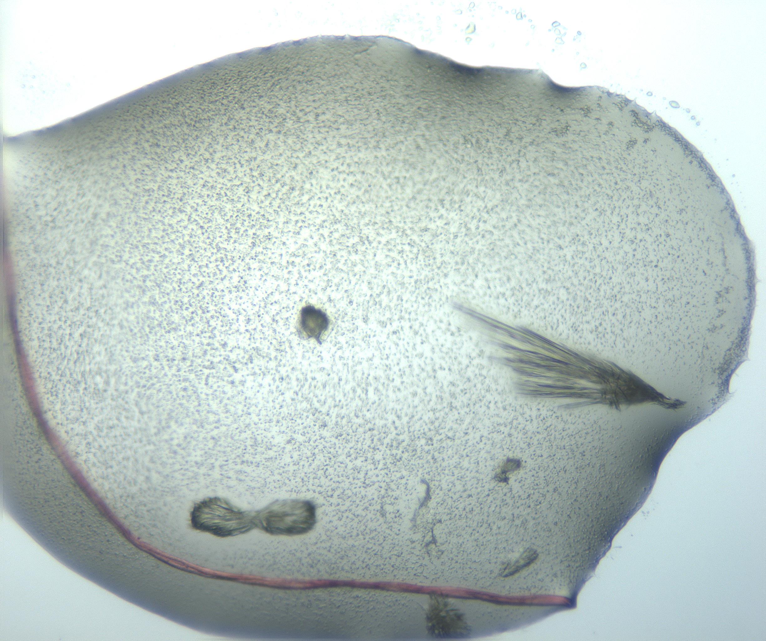 RI01_03_000_0212_Proj1_Clon1_MC_0000MC103026_015_170122_05_07_01_00_99_002_001_RAI.jpg