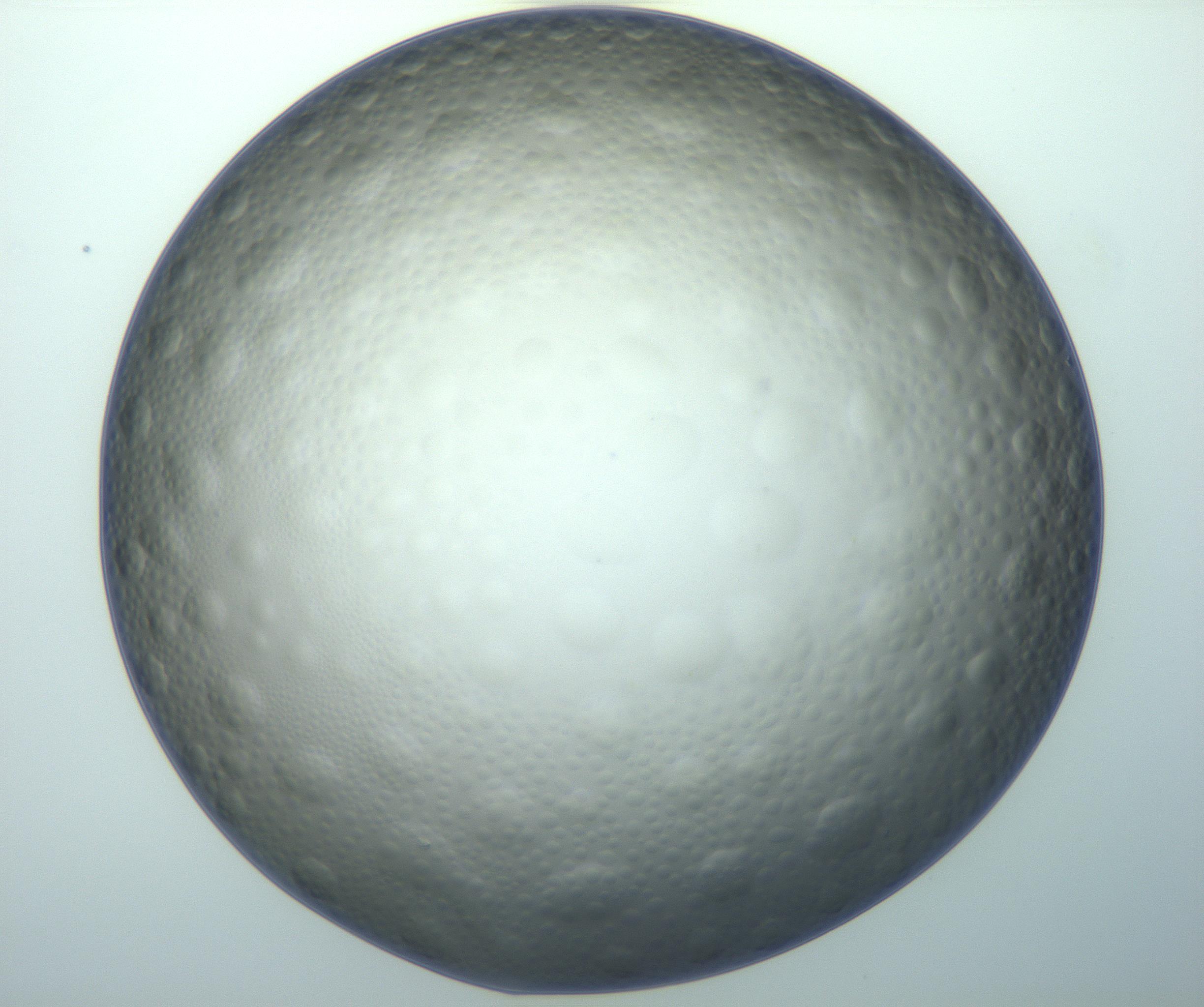 RI01_03_000_0212_Proj1_Clon1_MC_0000MC103119_002_161210_07_03_02_00_99_002_001_RAI.jpg