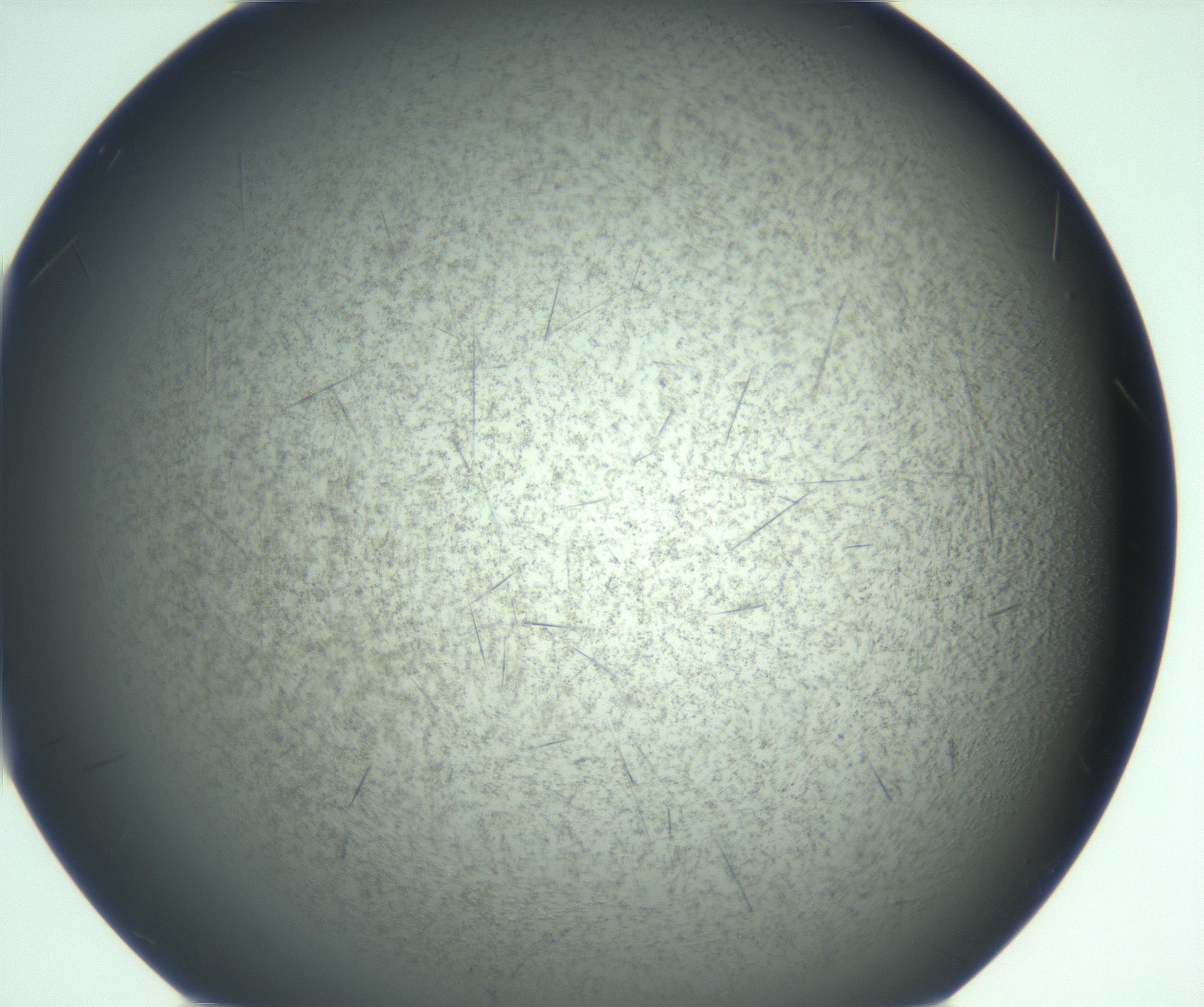 RI01_03_000_0212_Proj1_Clon1_MC_0000MC103167_006_161231_07_05_02_00_99_002_001_RAI.jpg