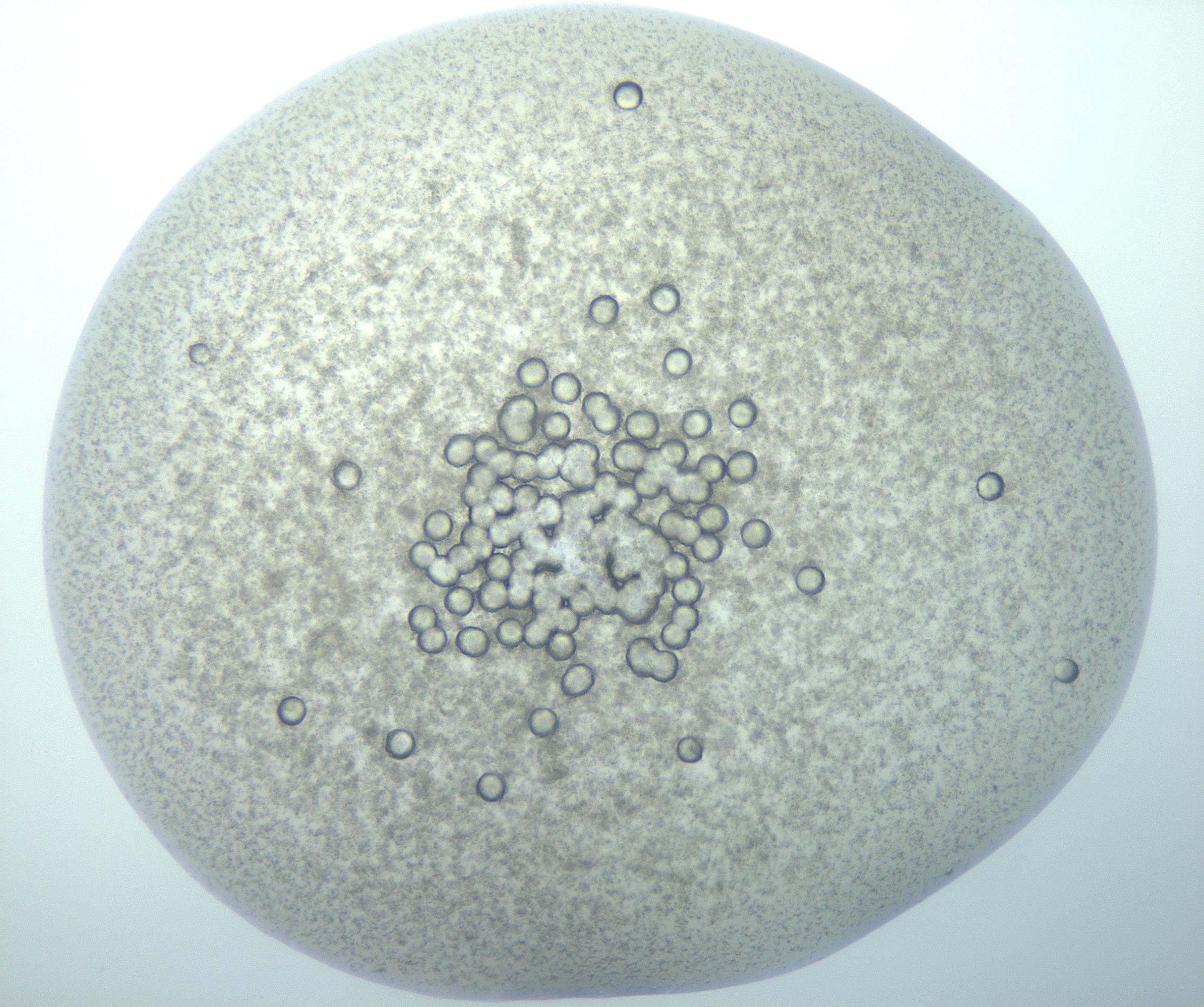 RI01_03_000_0212_Proj1_Clon1_MC_0000MC103189_005_161229_10_06_02_00_99_002_001_RAI.jpg