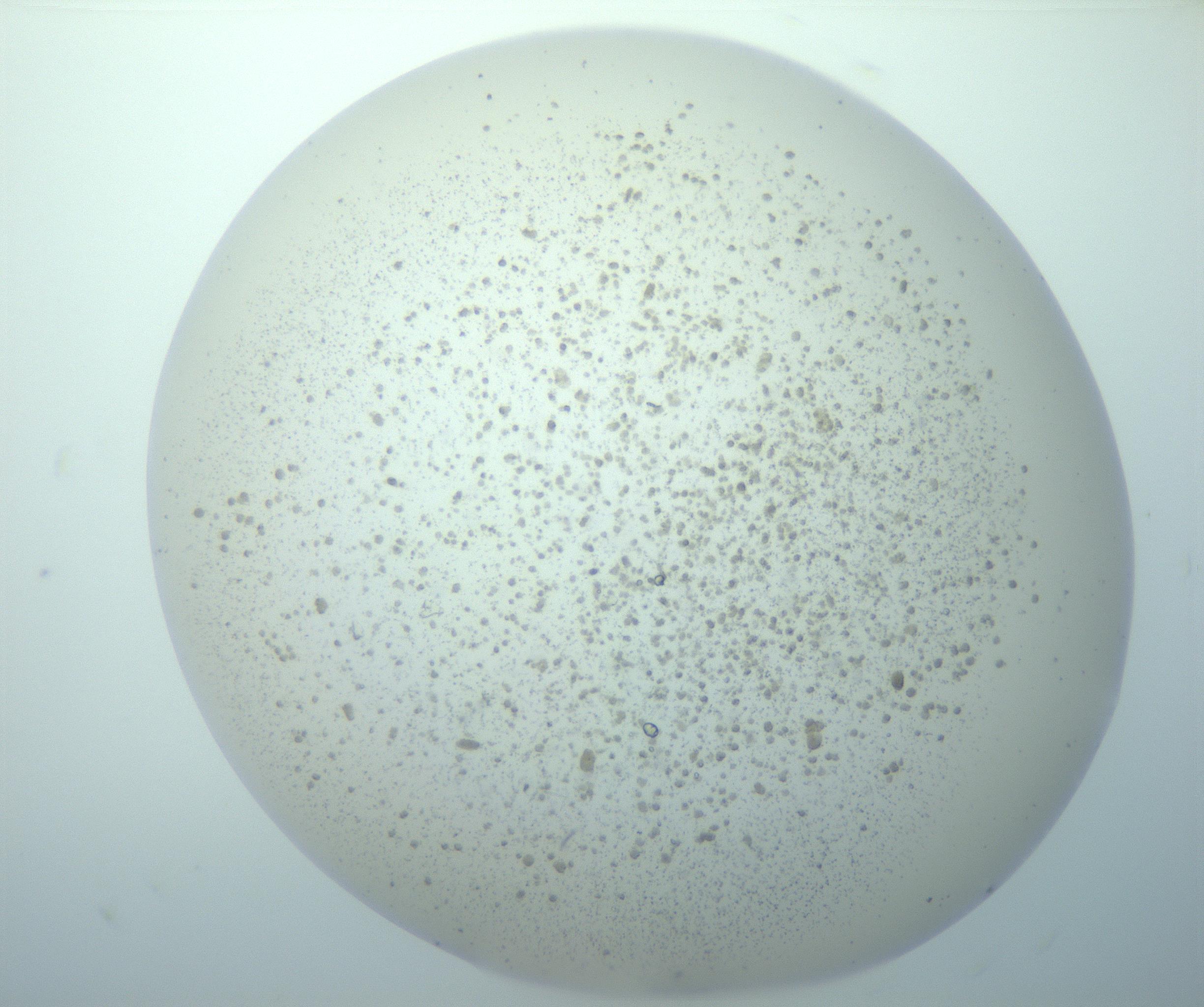RI01_03_000_0212_Proj1_Clon1_MC_0000MC103191_005_161229_03_04_02_00_99_002_001_RAI.jpg