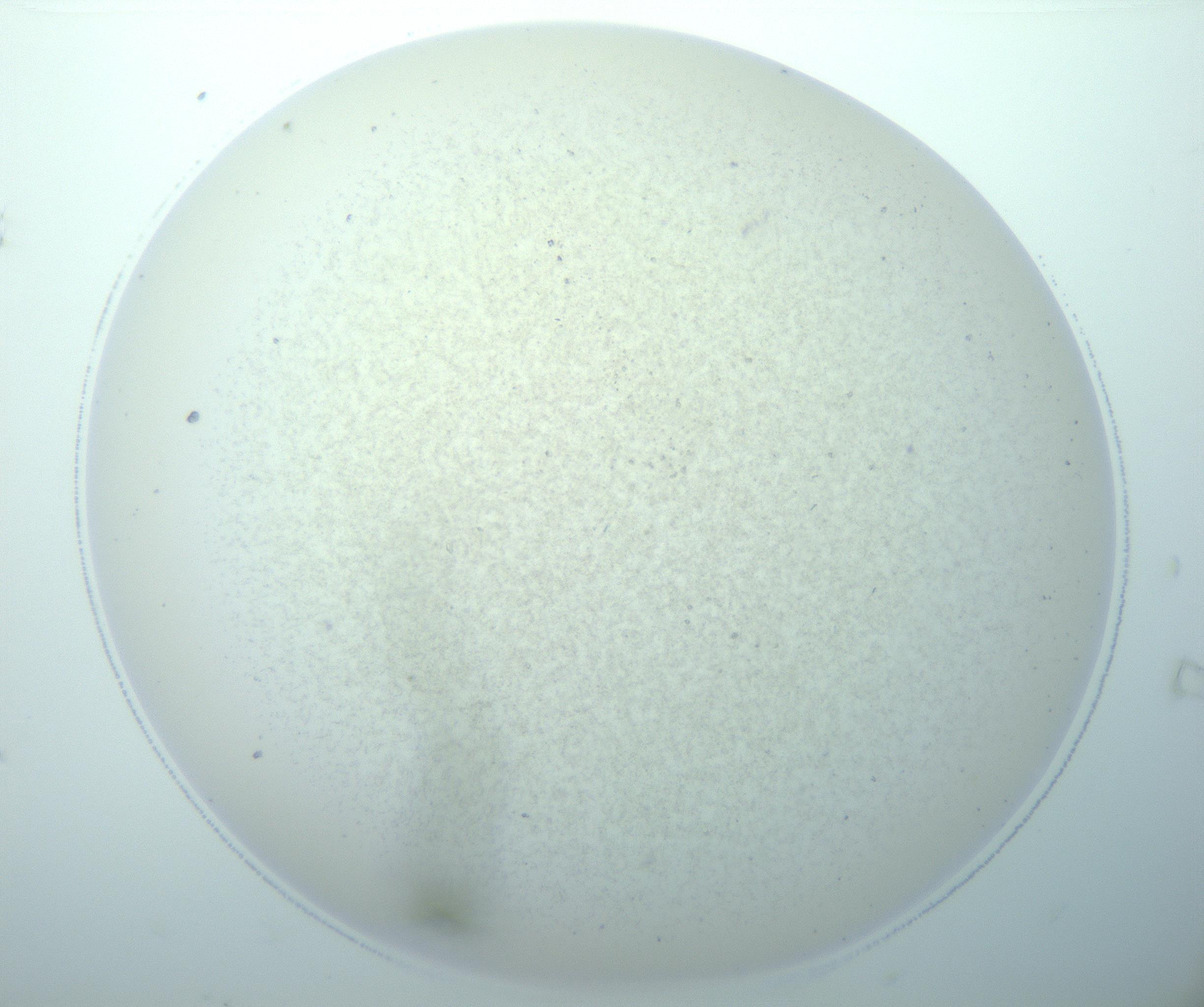 RI01_03_000_0212_Proj1_Clon1_MC_0000MC103192_007_170105_07_01_02_00_99_002_001_RAI.jpg