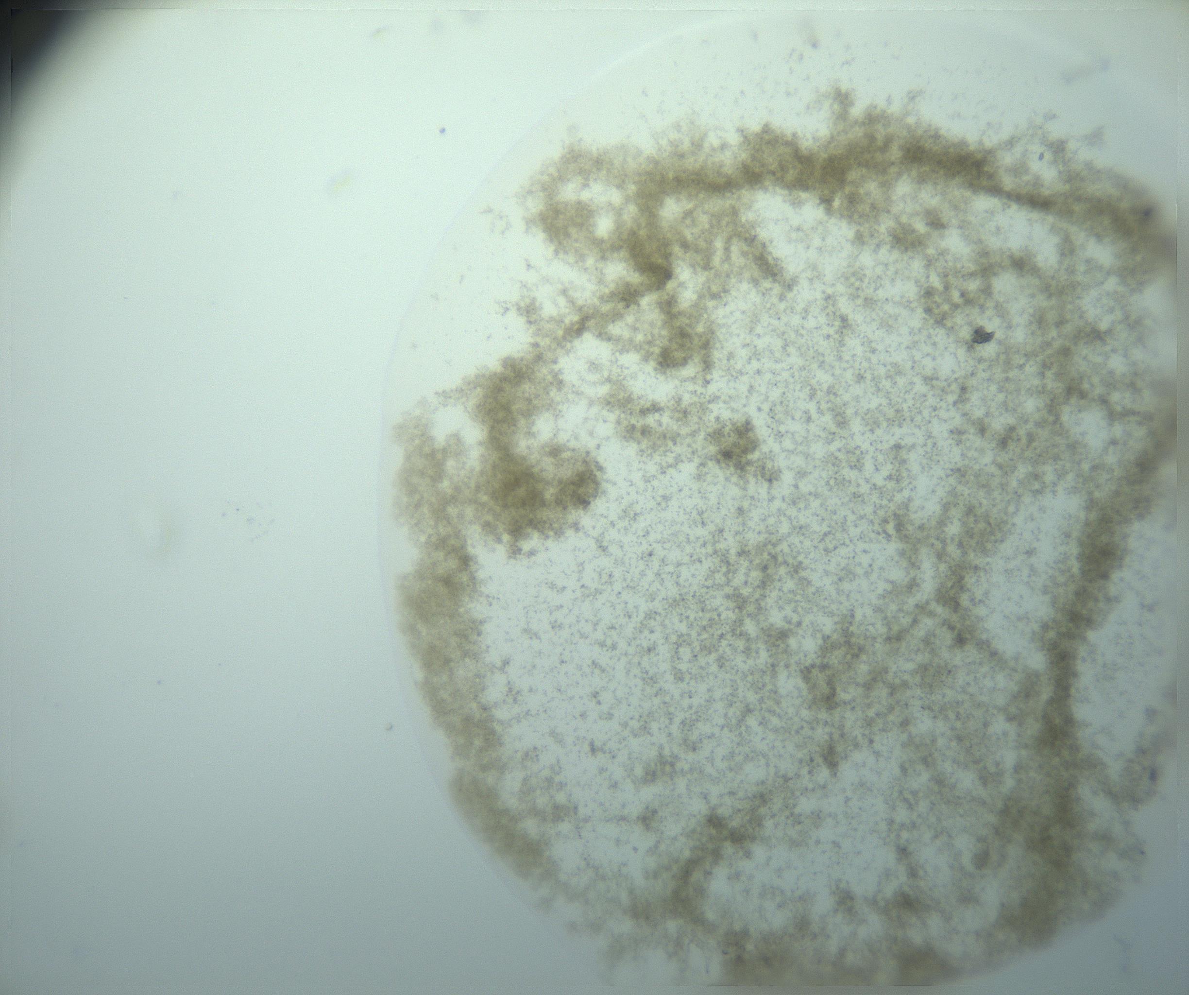 RI01_03_000_0212_Proj1_Clon1_MC_0000MC103195_010_170126_04_04_02_00_99_002_001_RAI.jpg