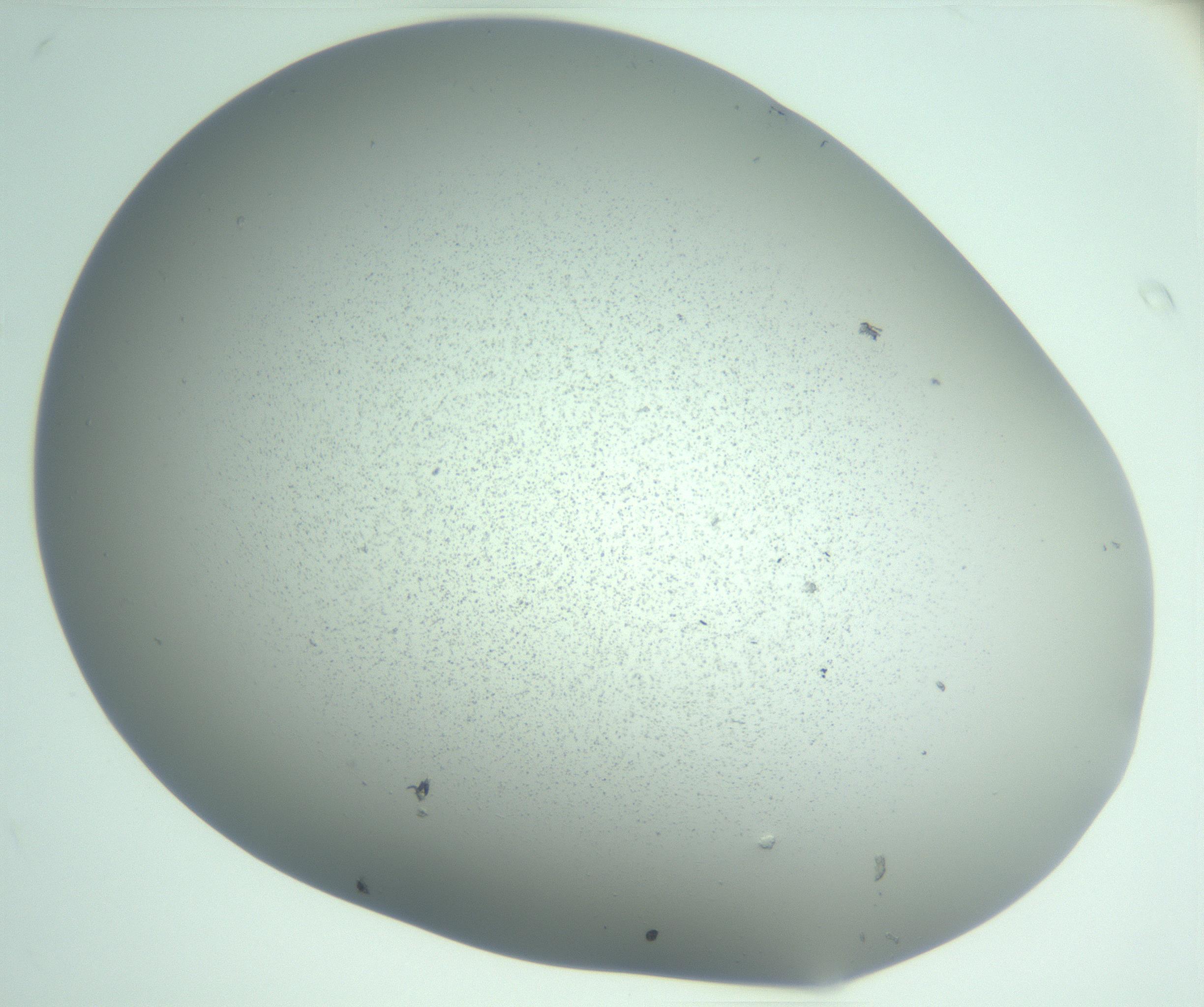RI01_03_000_0212_Proj1_Clon1_MC_0000MC103221_002_170125_02_07_02_00_99_002_001_RAI.jpg
