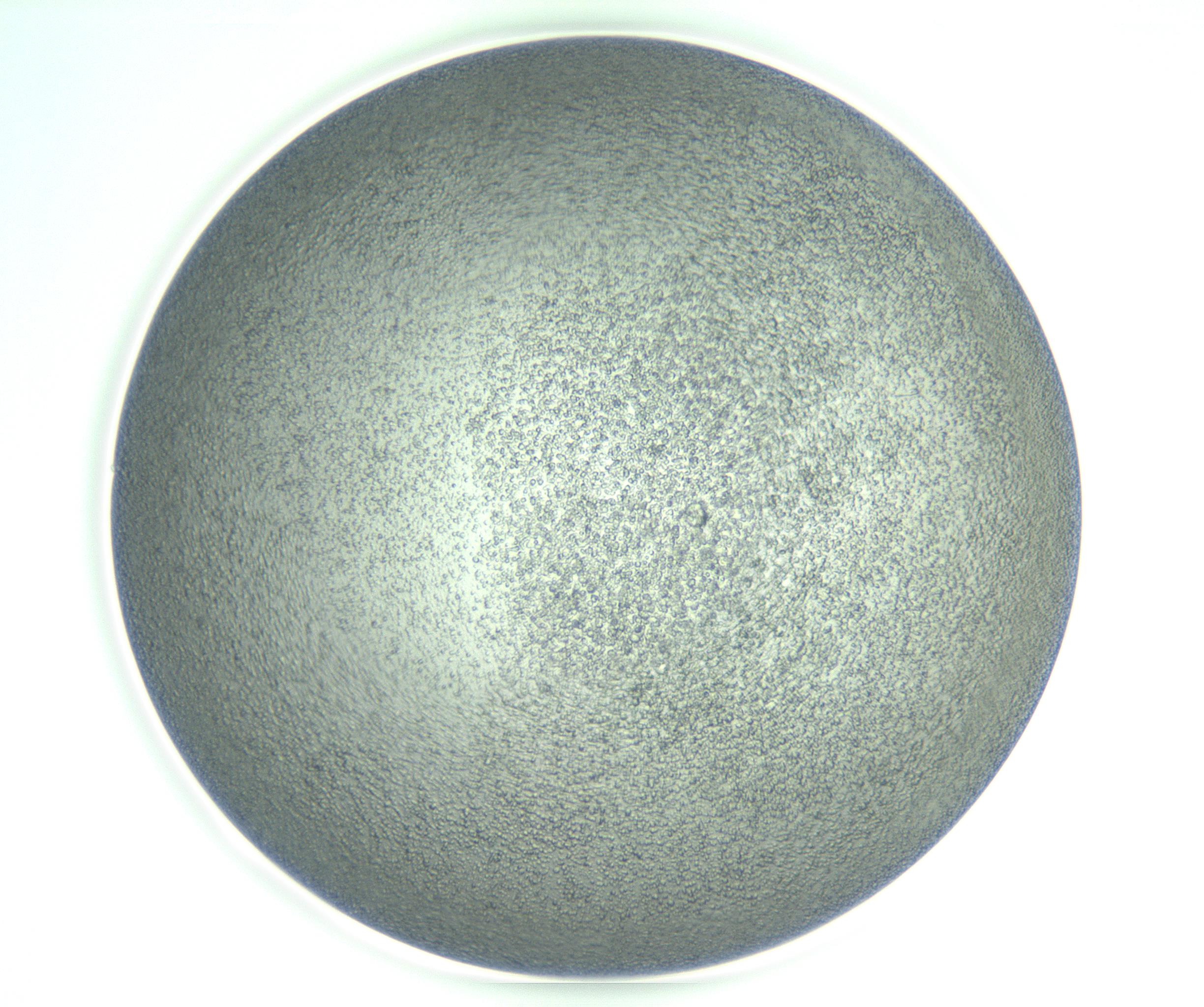 RI01_03_000_0212_Proj1_Clon1_MC_0000MC103234_007_170210_02_07_01_00_99_002_001_RAI.jpg
