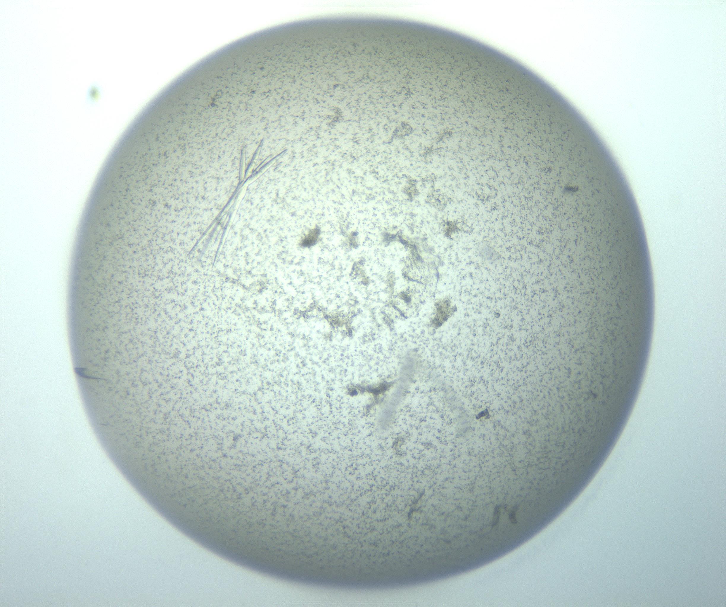 RI01_03_000_0212_Proj1_Clon1_MC_0000MC103271_003_170213_11_04_01_00_99_002_001_RAI.jpg