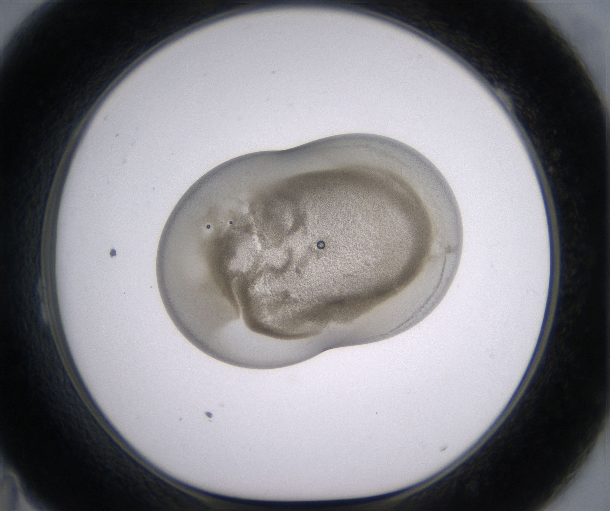 B11_HighResolution_Precipitate_1.jpg