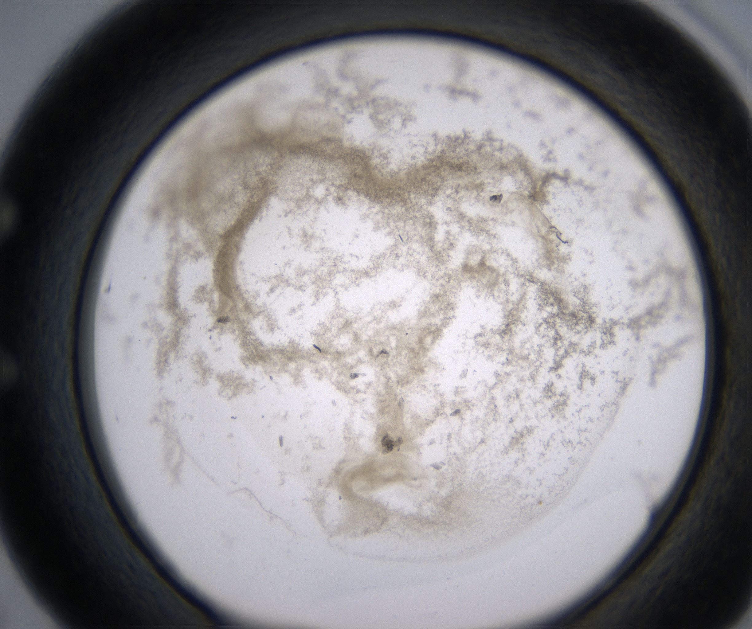 E5_HighResolution_Precipitate_1.jpg