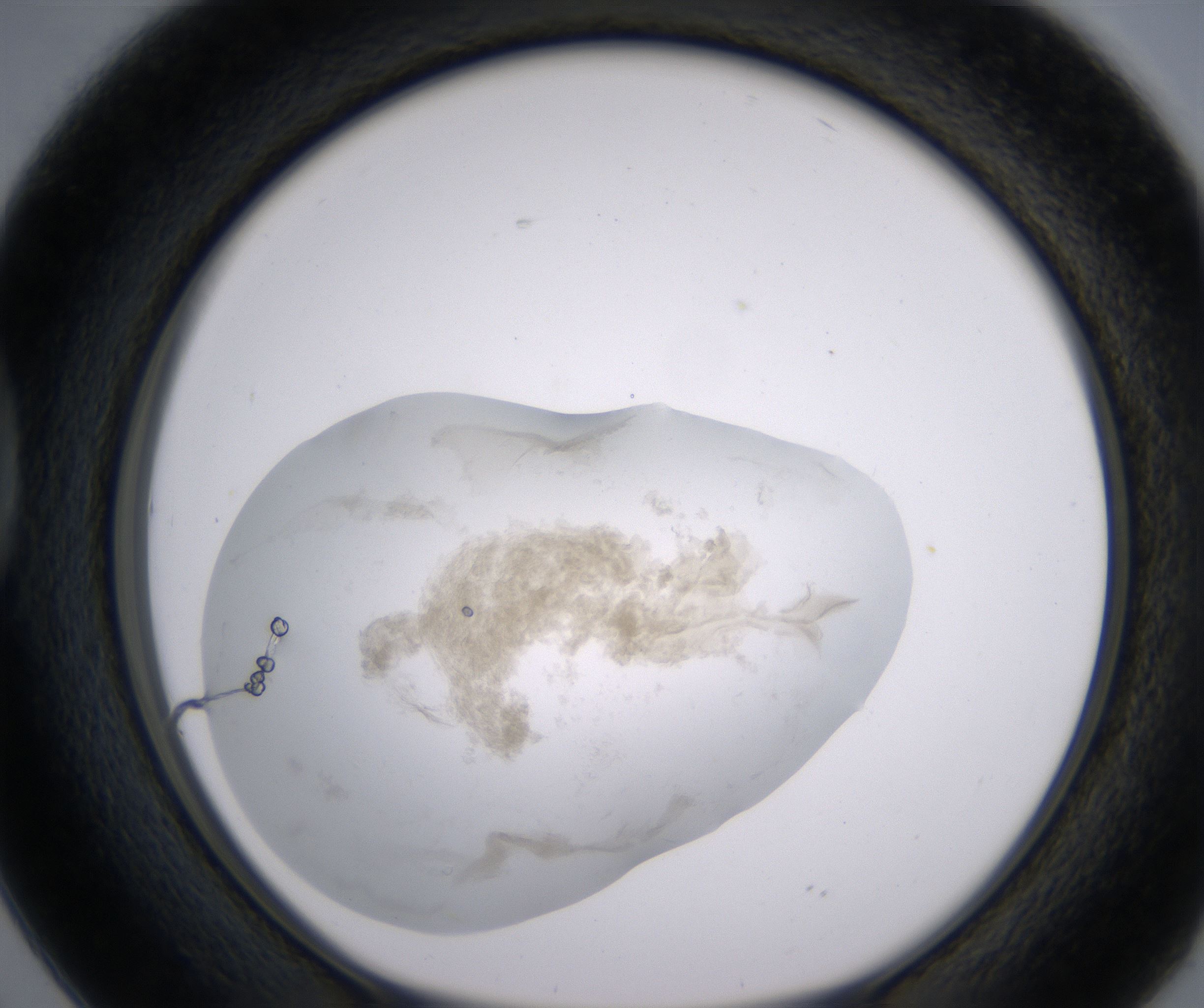 D2_HighResolution_Precipitate_1.jpg
