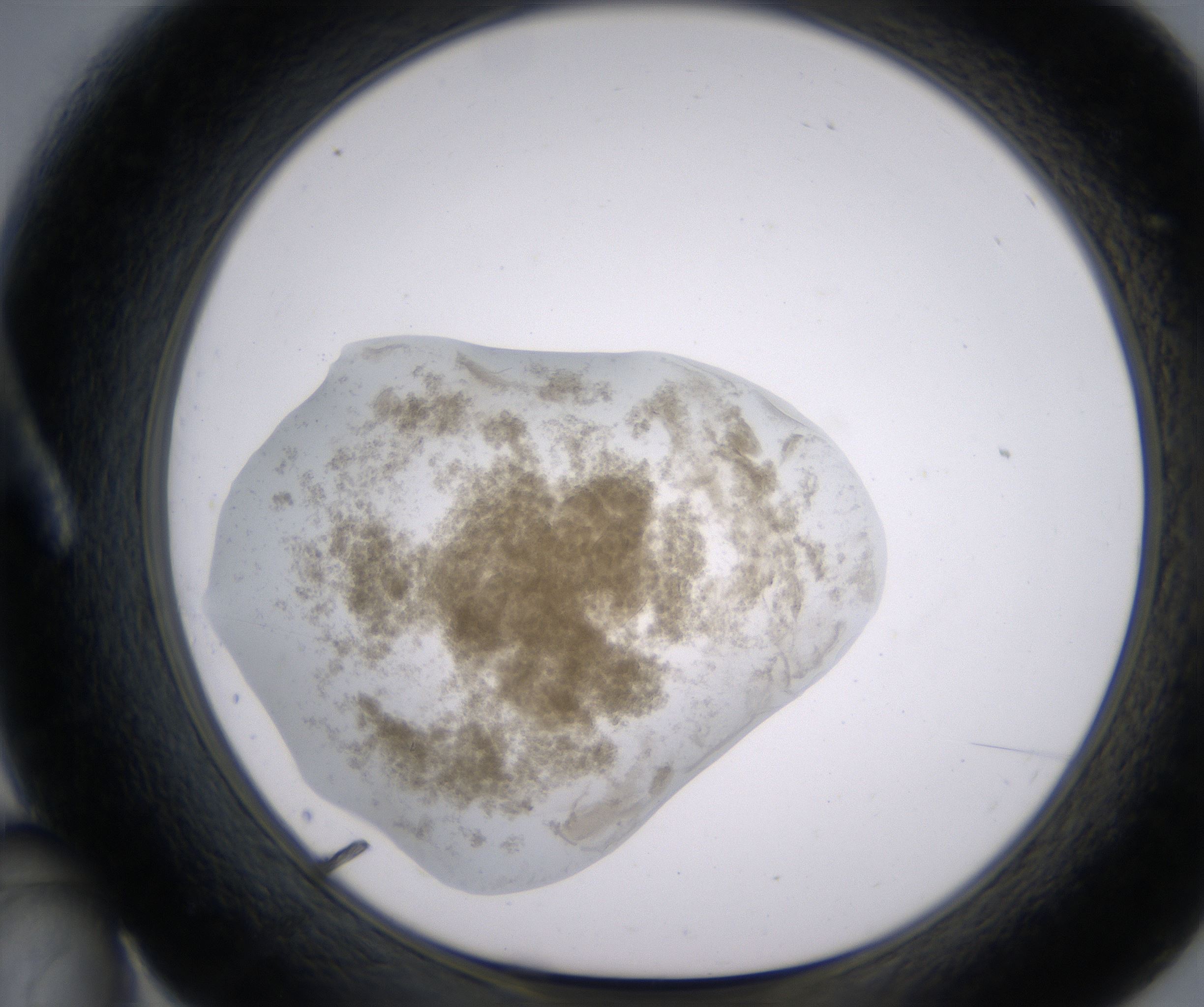 A10_HighResolution_Precipitate_1.jpg