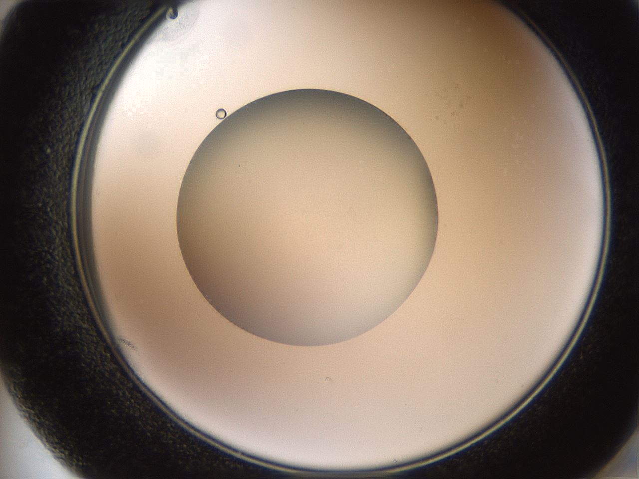 folderID620_plateID1620_batchID6748_wellNum72_profileID1_d2_r108103_ef.jpg