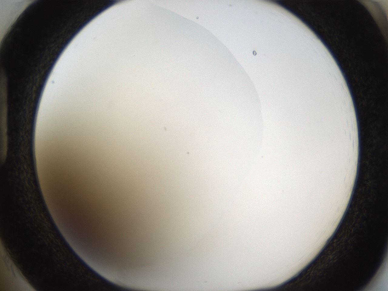 folderID214_plateID1214_batchID3712_wellNum85_profileID1_d1_r69704_ef.jpg